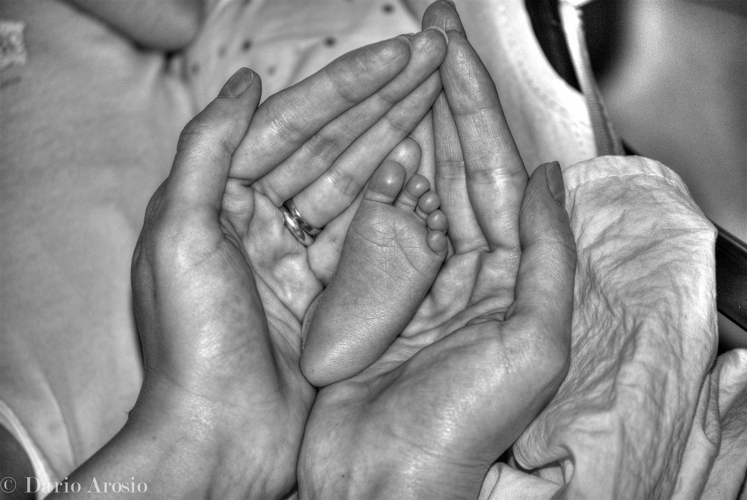 The leg of my daughter