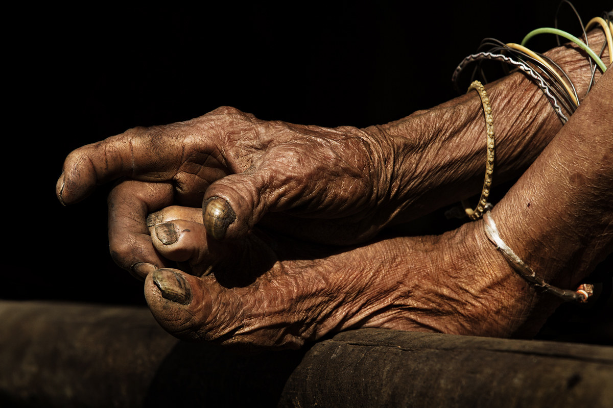 100 years of hard life!