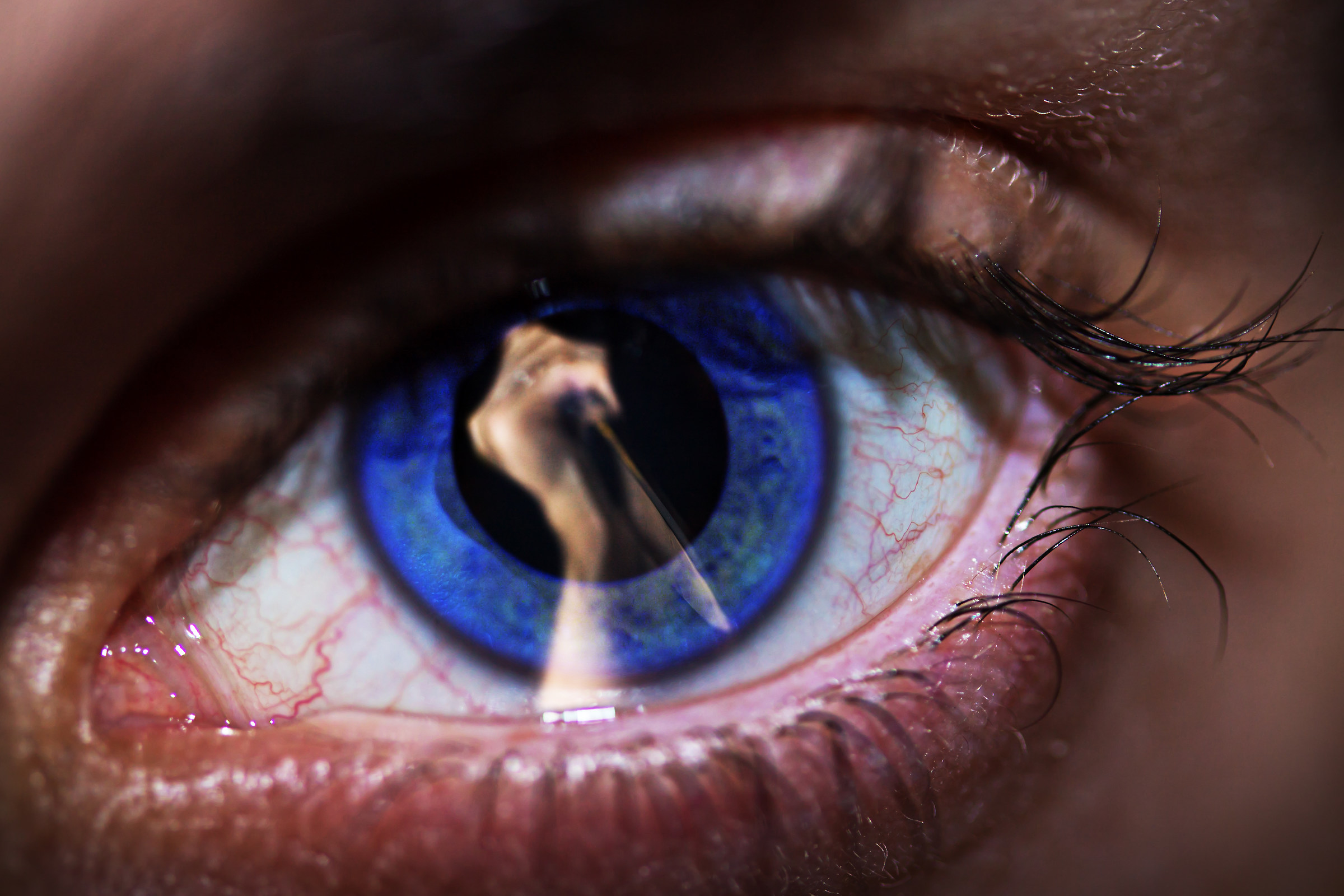 Con la morte in faccia