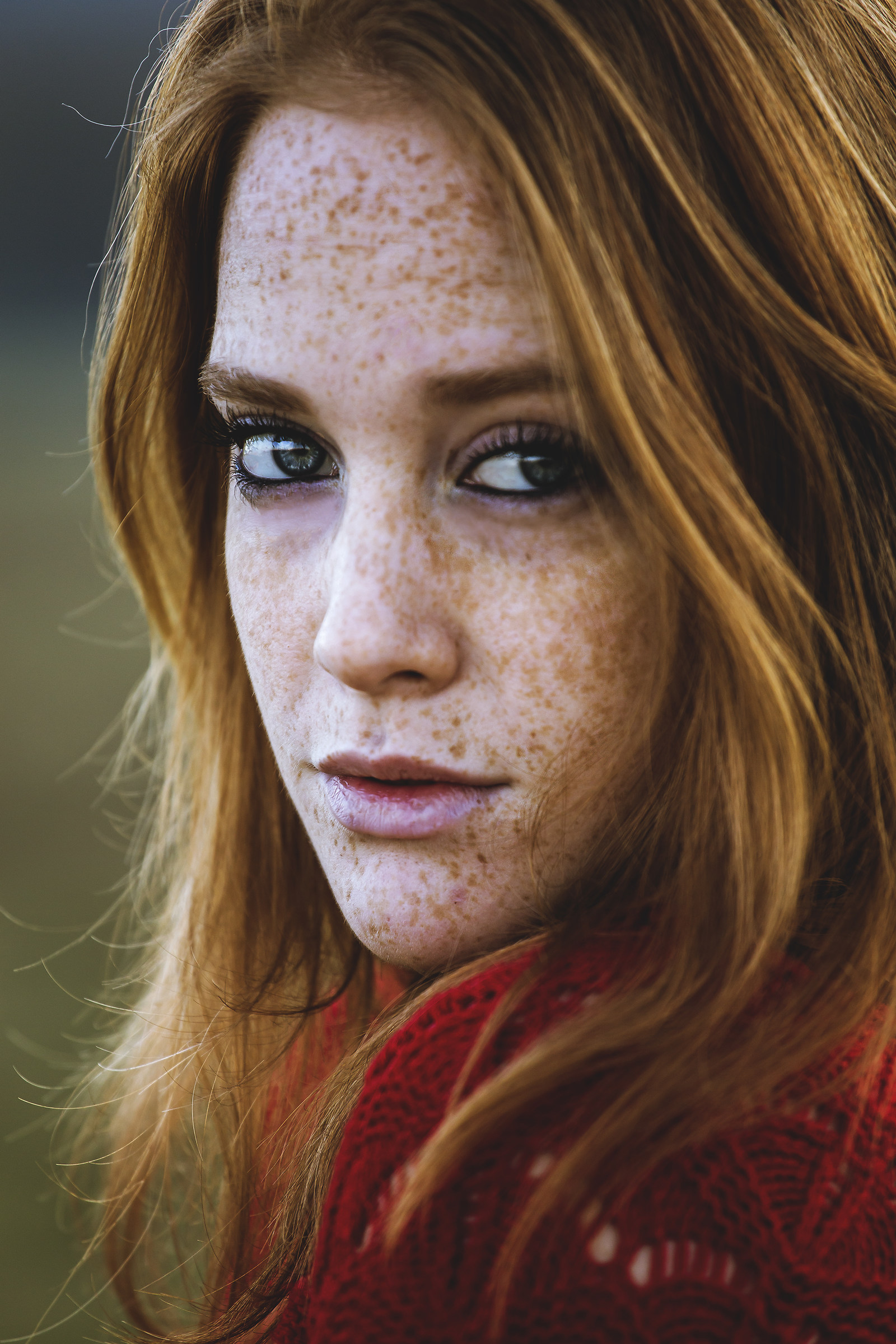 Freckles.