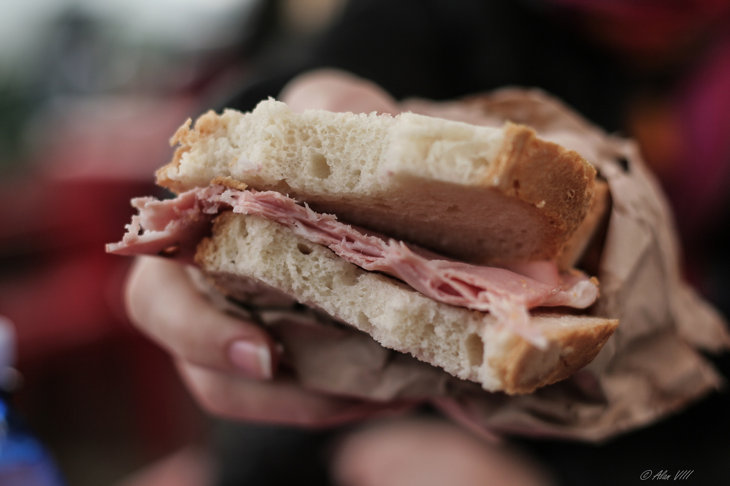 When you say get your teeth ...