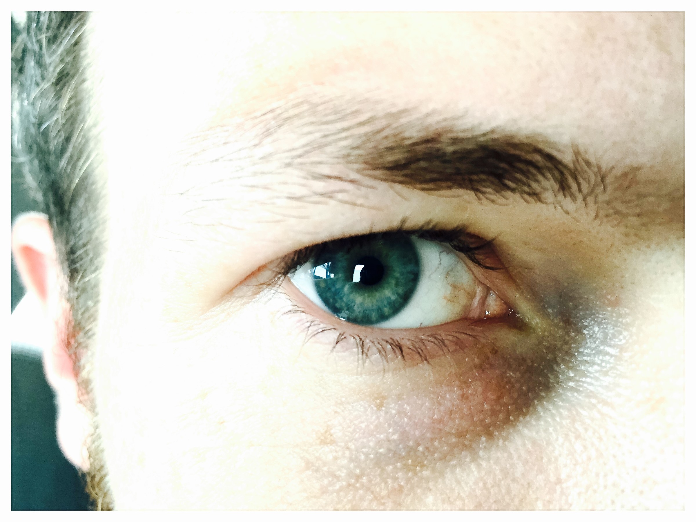 The window to the soul.