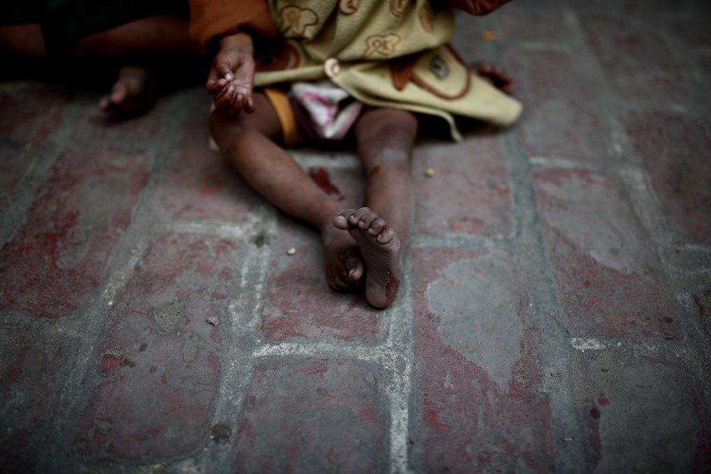 Una povertà impossibile da accettare