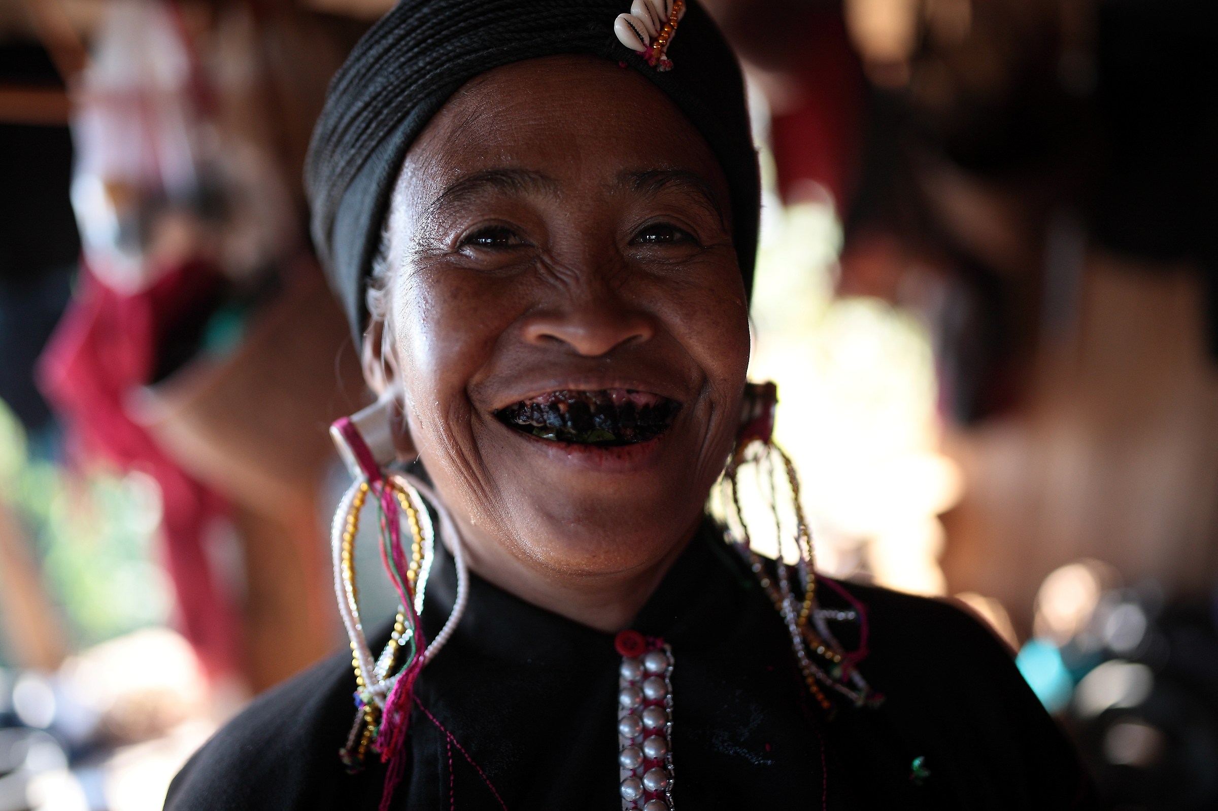 Woman by blacks teeth
