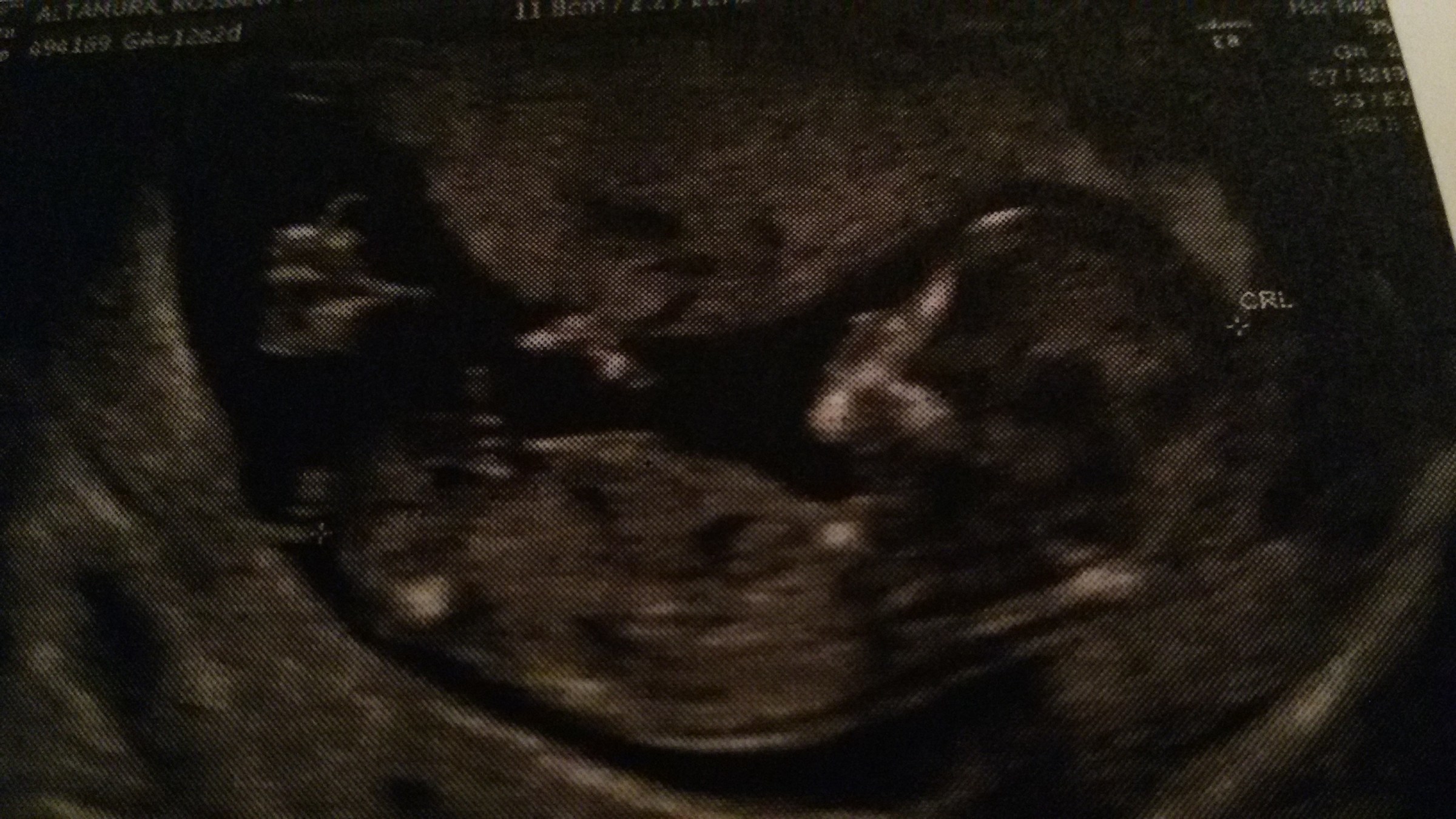 il tuo primo battito