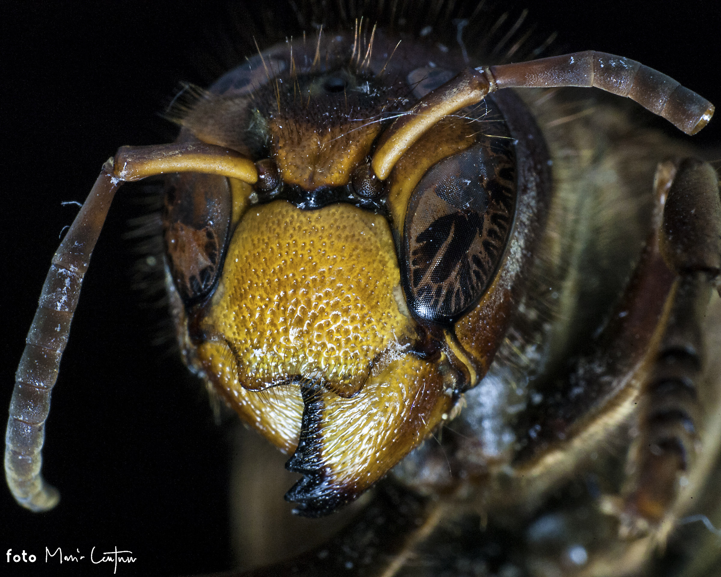 Pelle a buccia d'arancia?