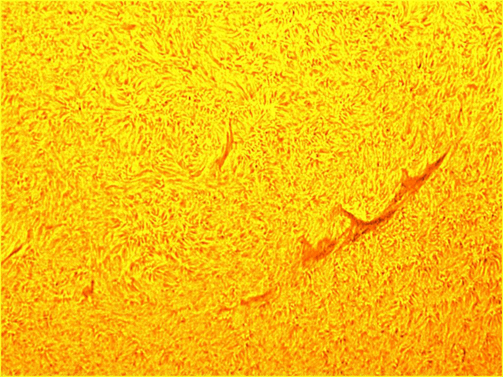 granulosità e filamenti solari