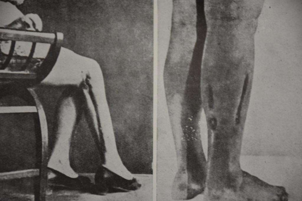 Altre cavie di esperimenti "medici"