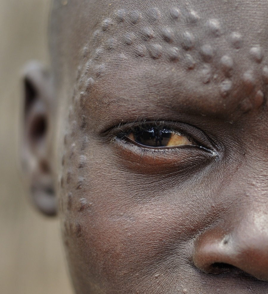 Una ragazza da copertina. Nakapelimoru, Karamoja