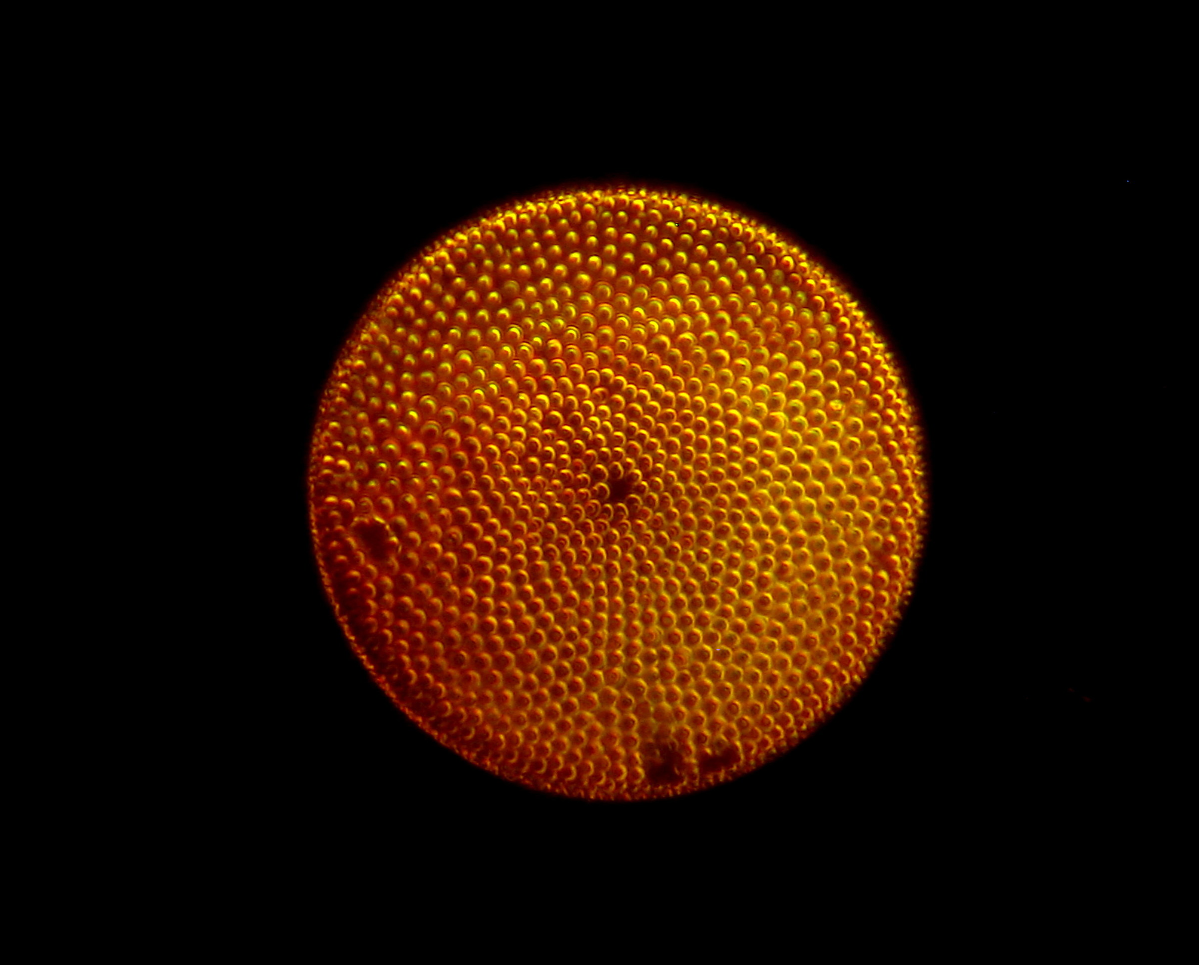 circular diatom