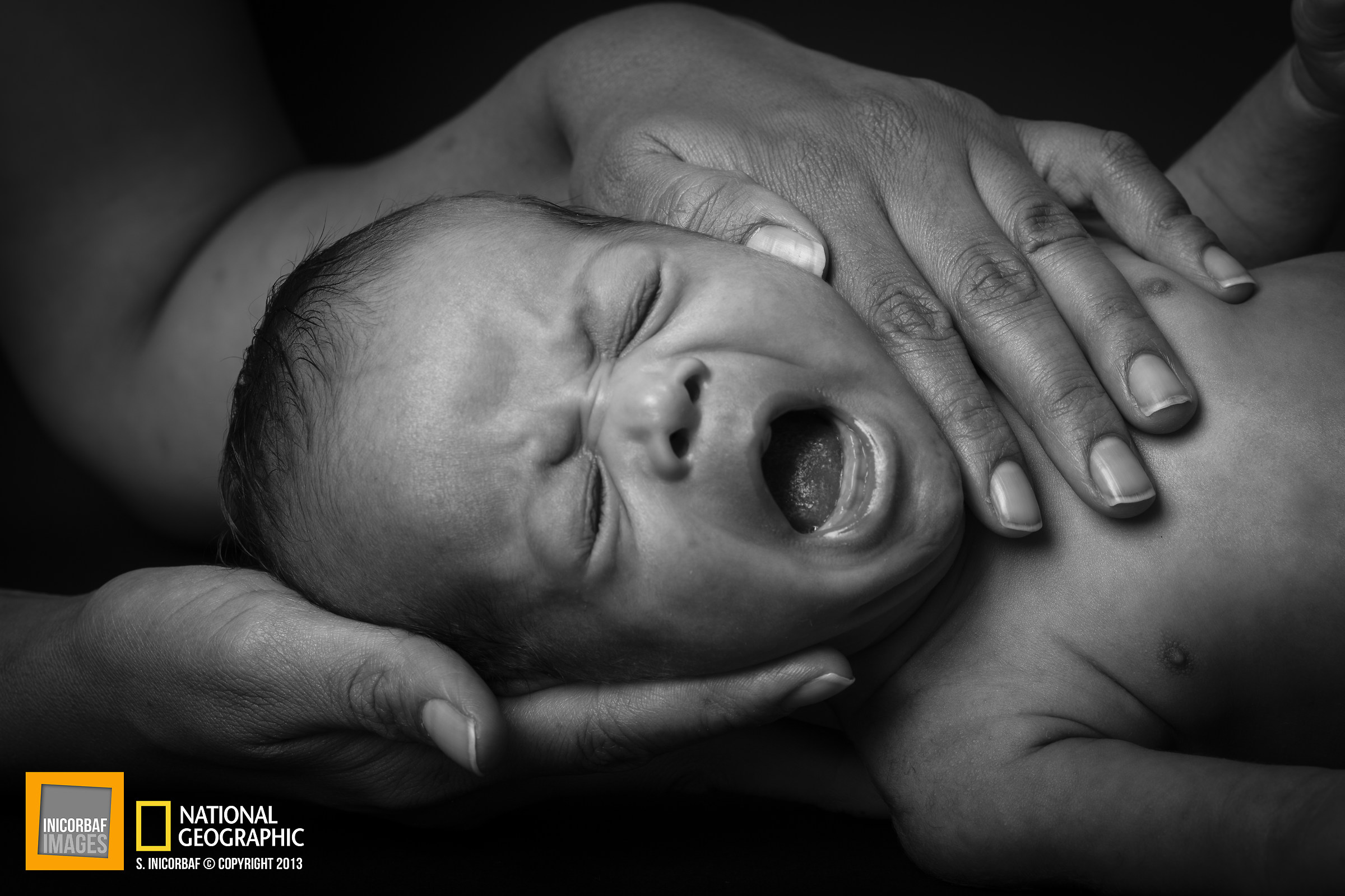 Birth of a premature baby in the Congo