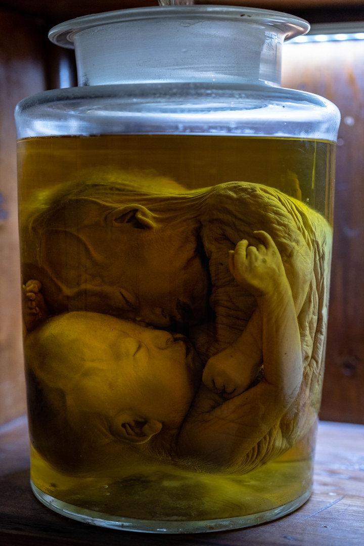 gallipoli 30 anni dopo......