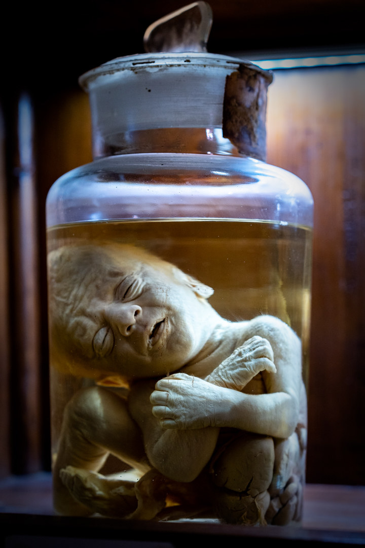 gallipoli 30 anni dopo......