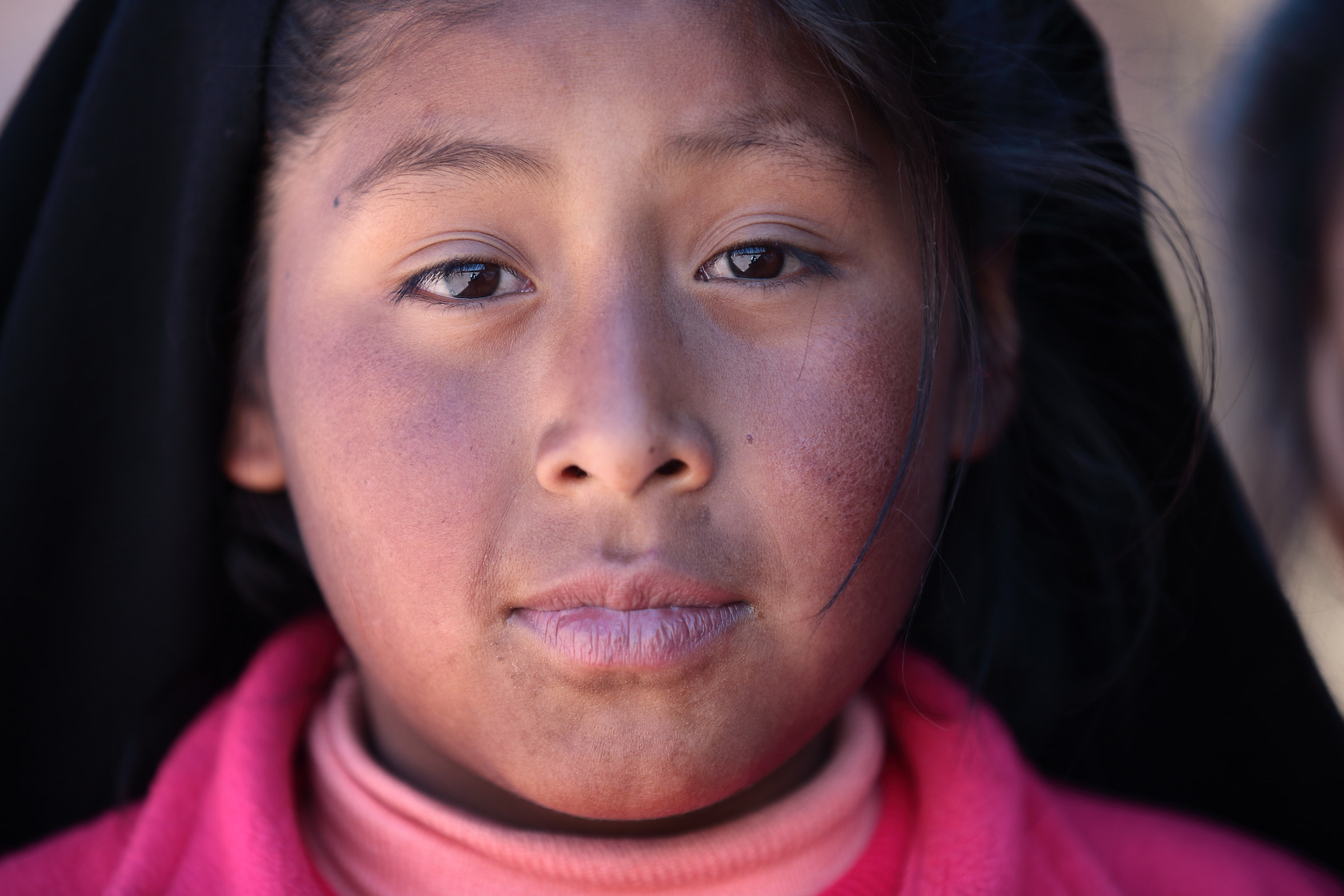 Il freddo segna il viso