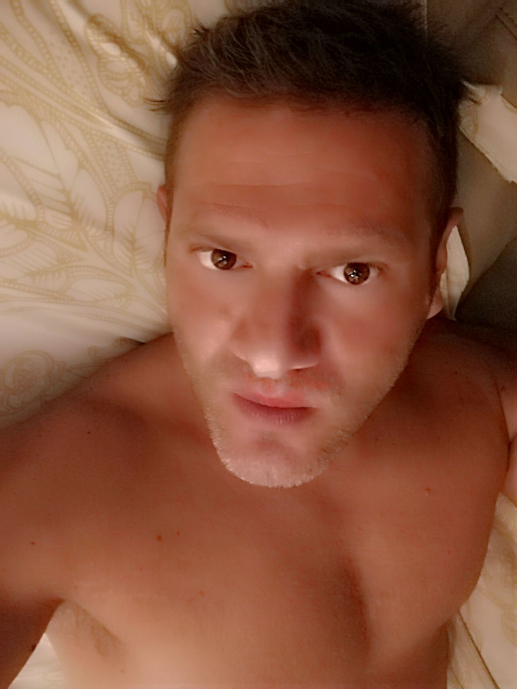 Abbronzatura... Troppo sole... ?