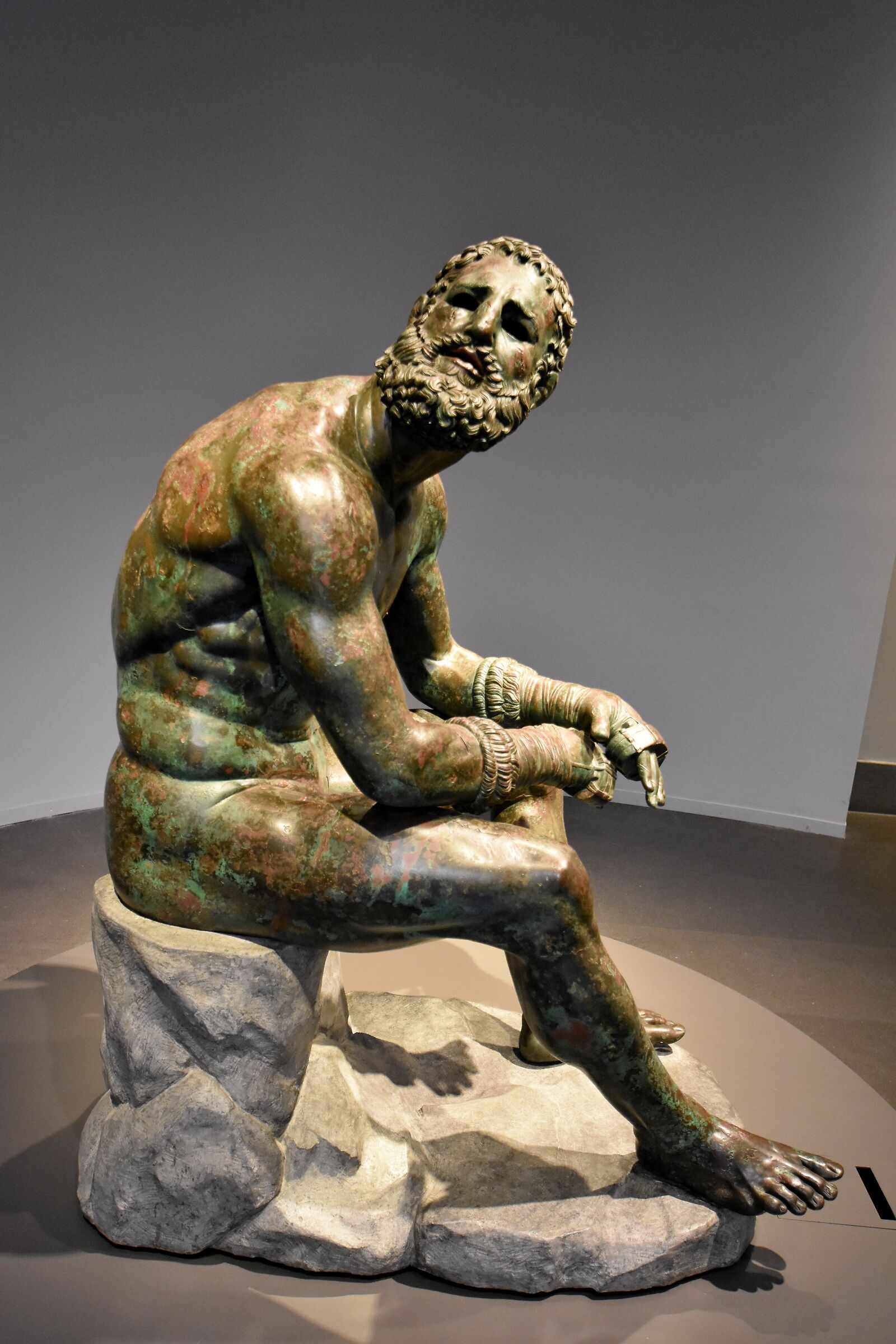 Museo Archeologico Romano- Pugilatore in riposo