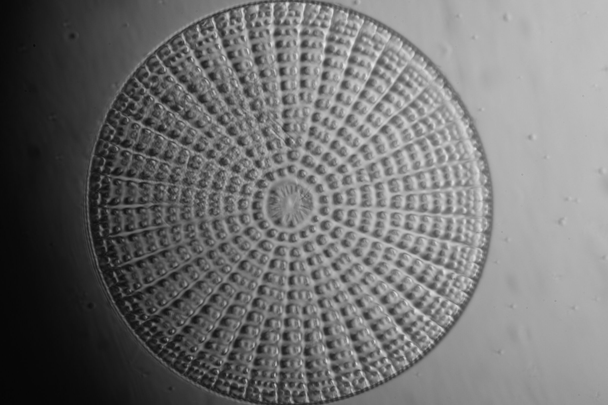 Arachnoidiscus Ornatus ill. laterale. Zeiss Standard RA