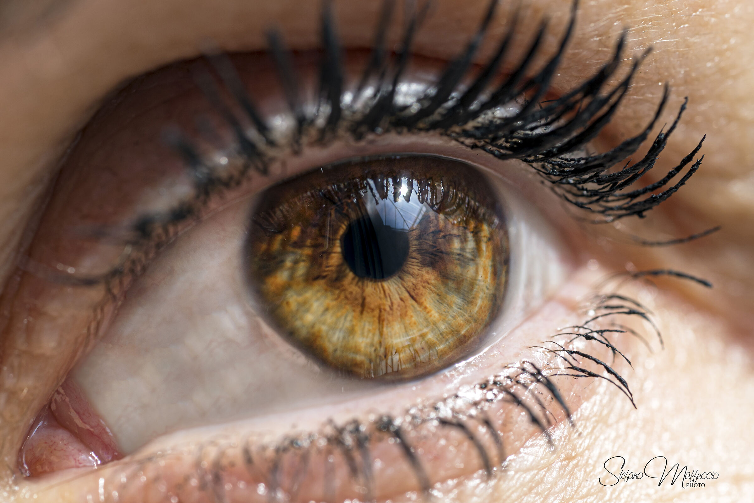 Eye
