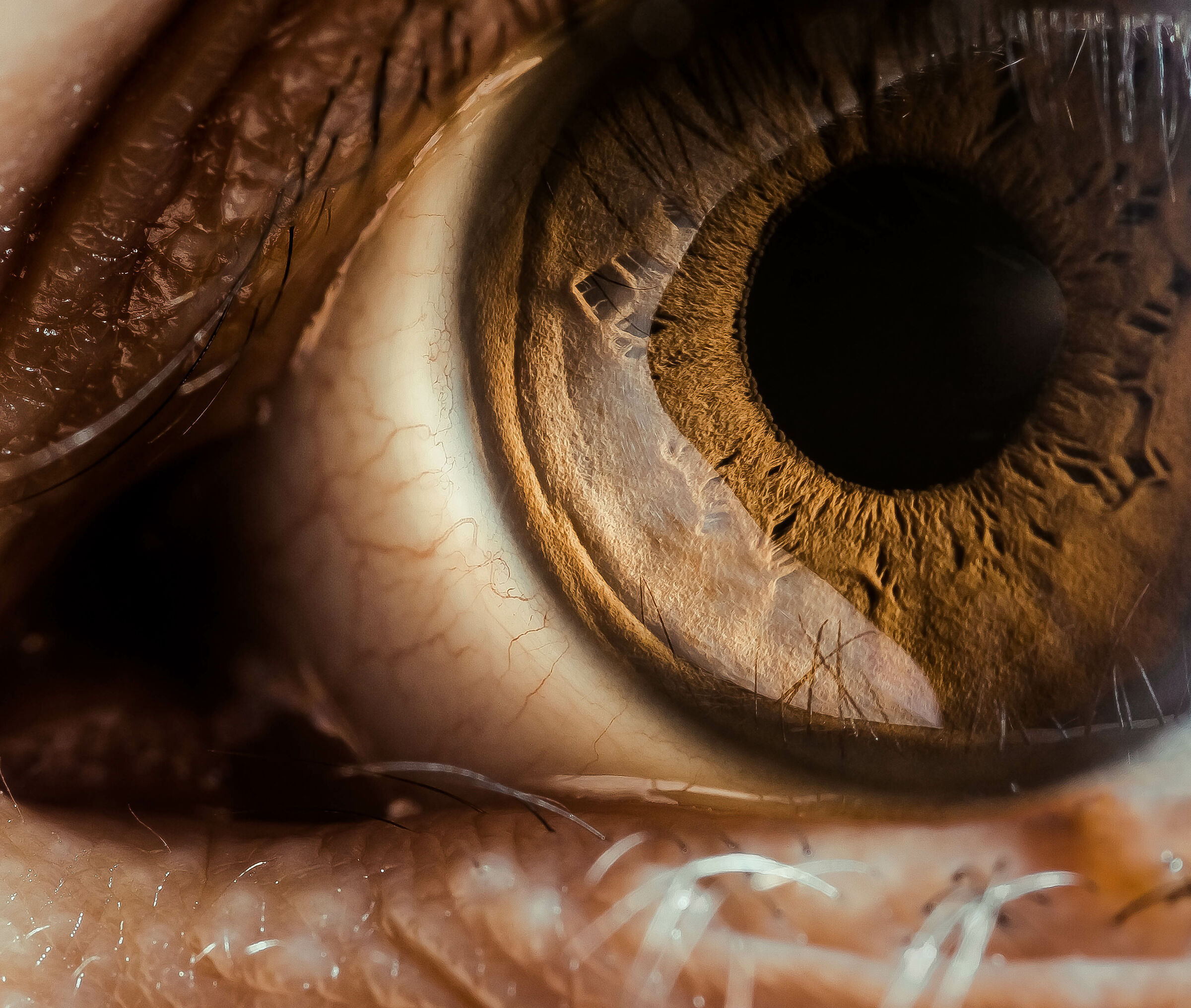 A Window to the Soul