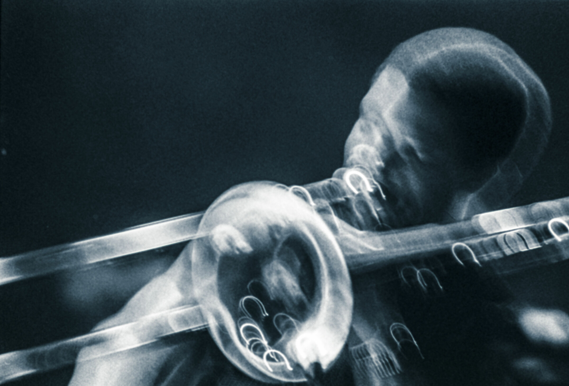 Robin Eubanks, an obligatory move