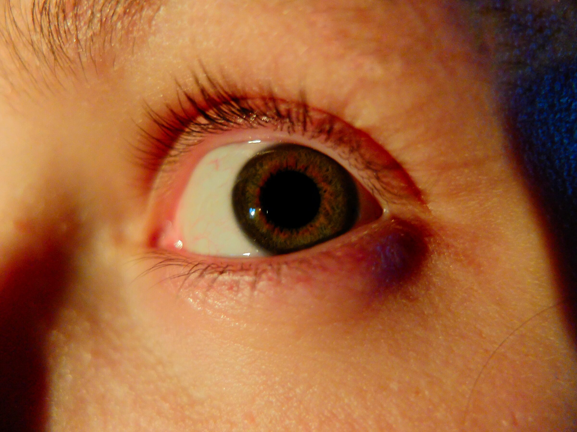 Eyes