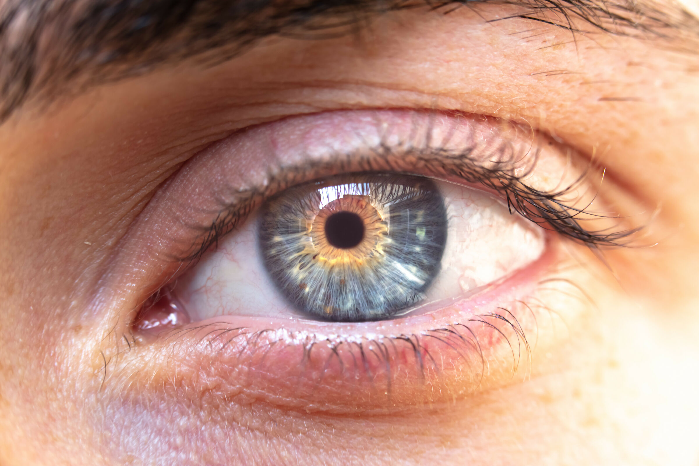 50 sfumature di iride