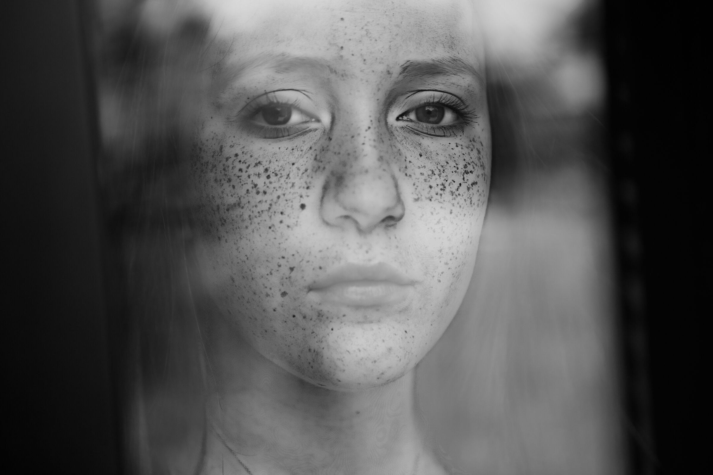 Freckles