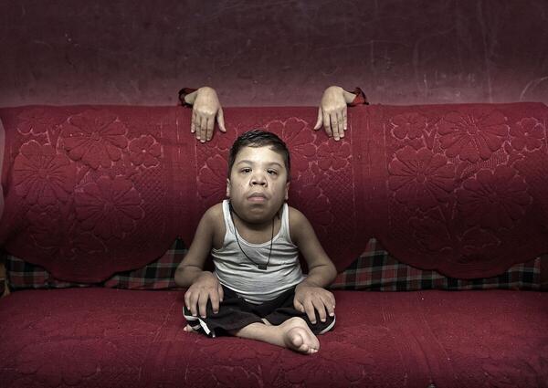 Foto