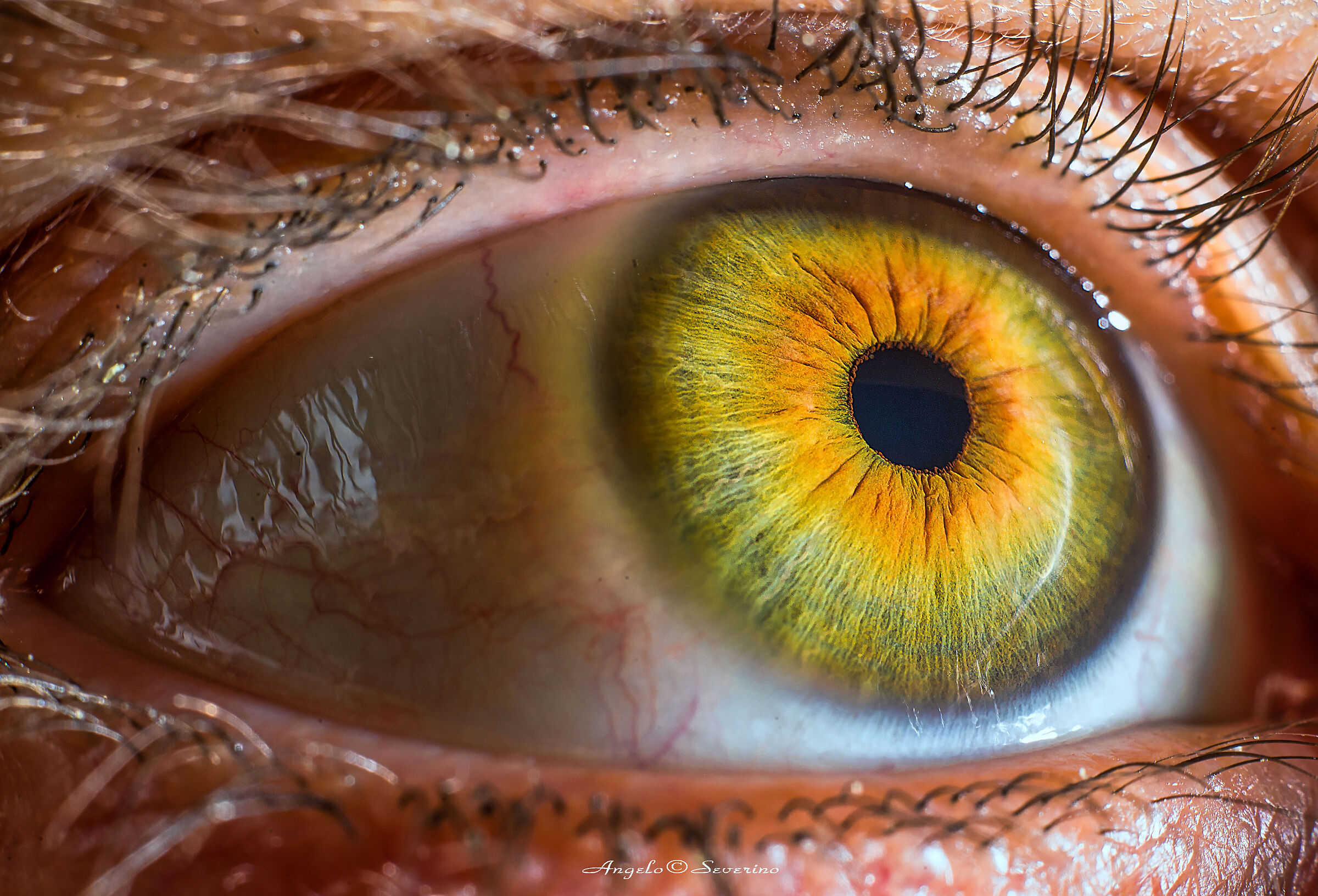 my eye