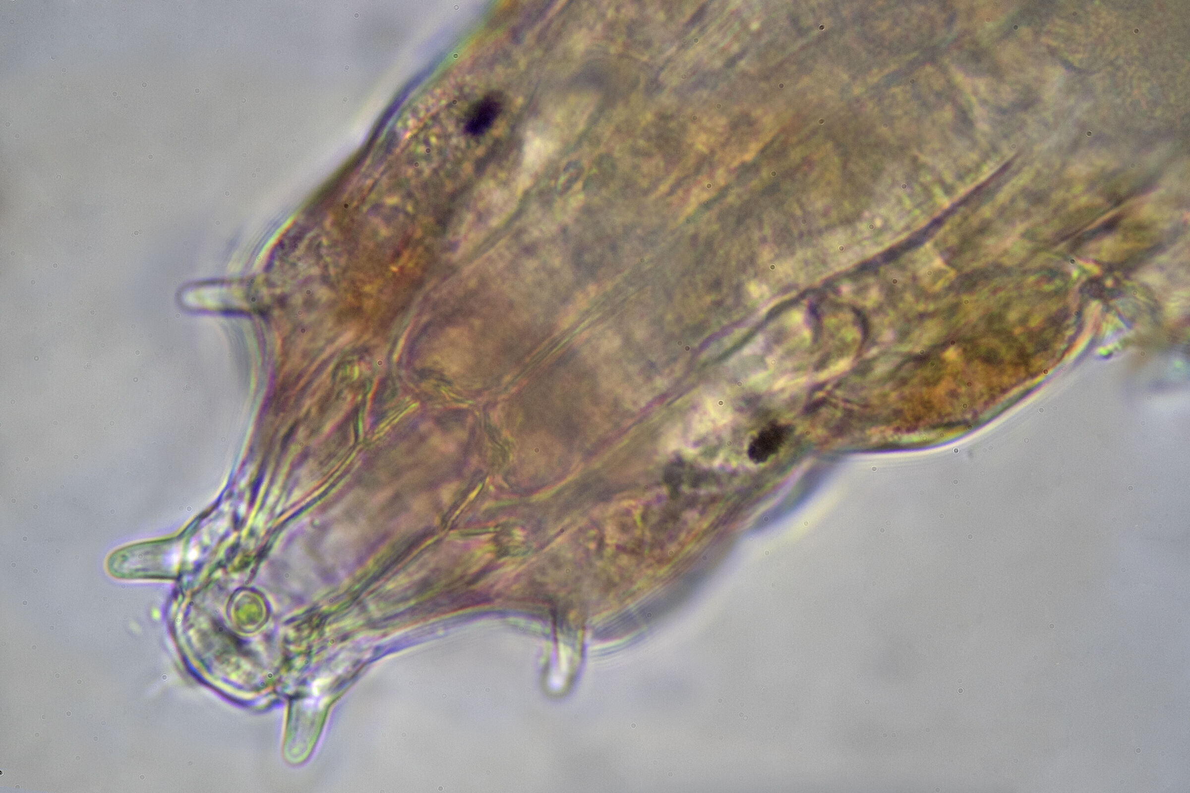 Face of a late-grade Milnesium at 100x