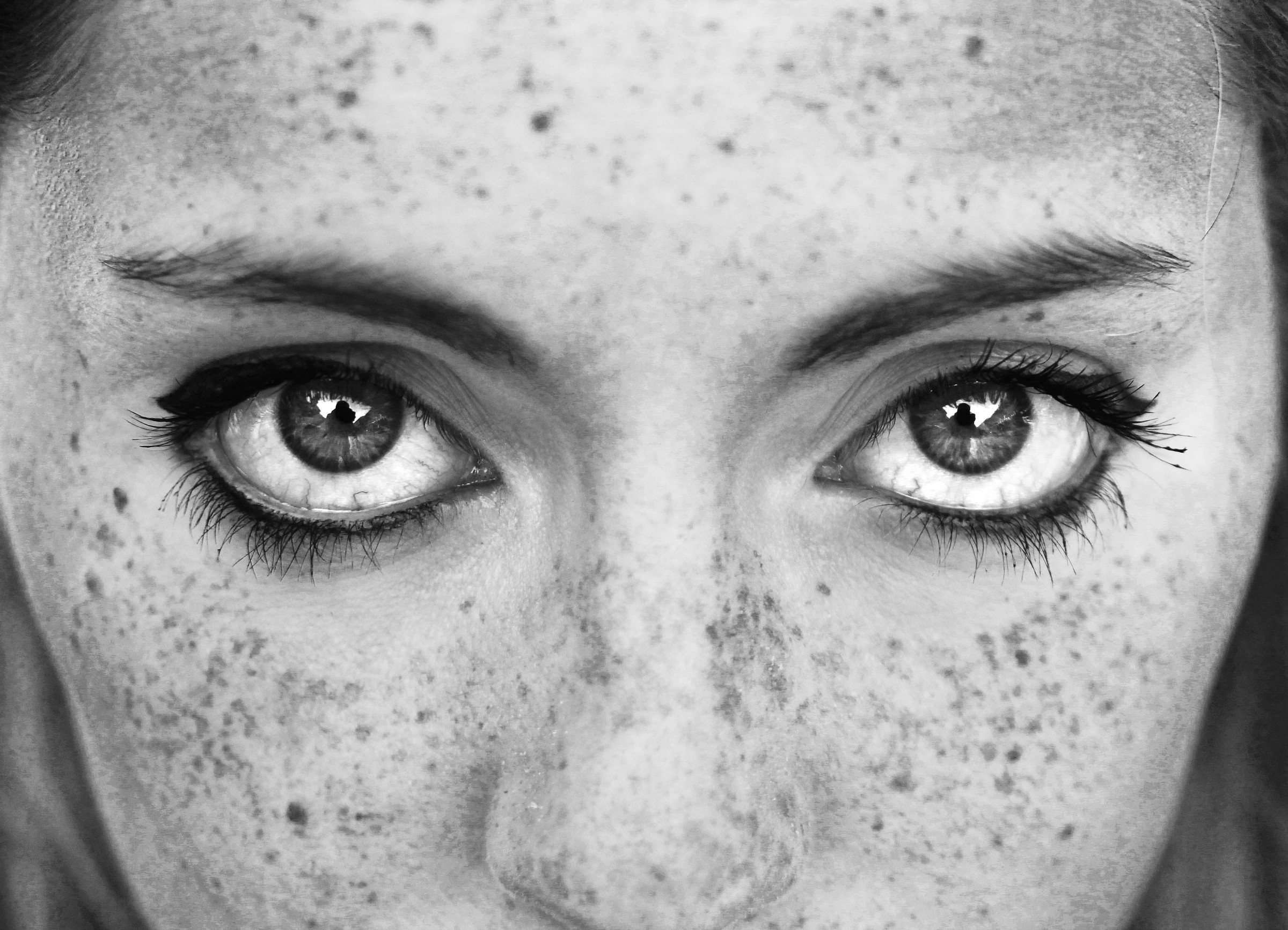 Freckles ..