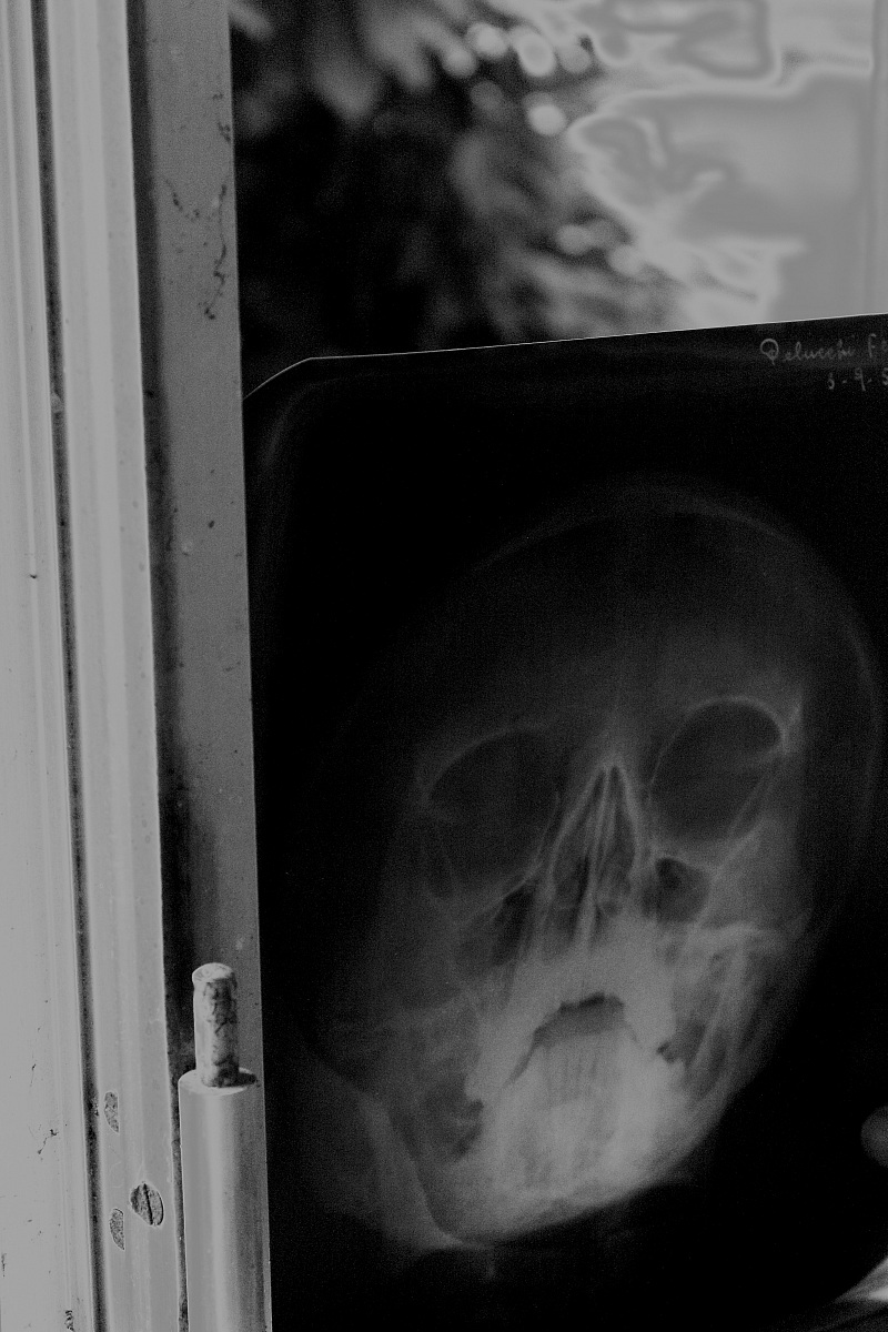 Manicomio di Mombello 89