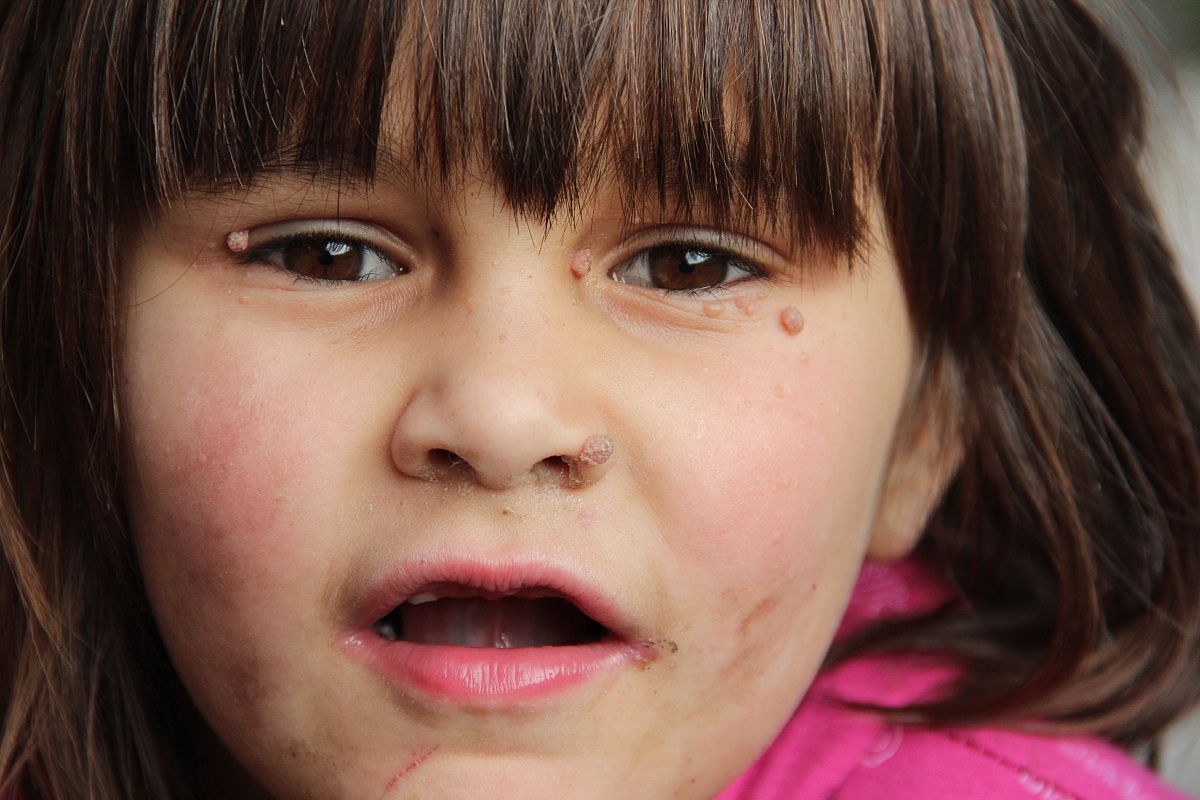 Bosnia and Herzegovina