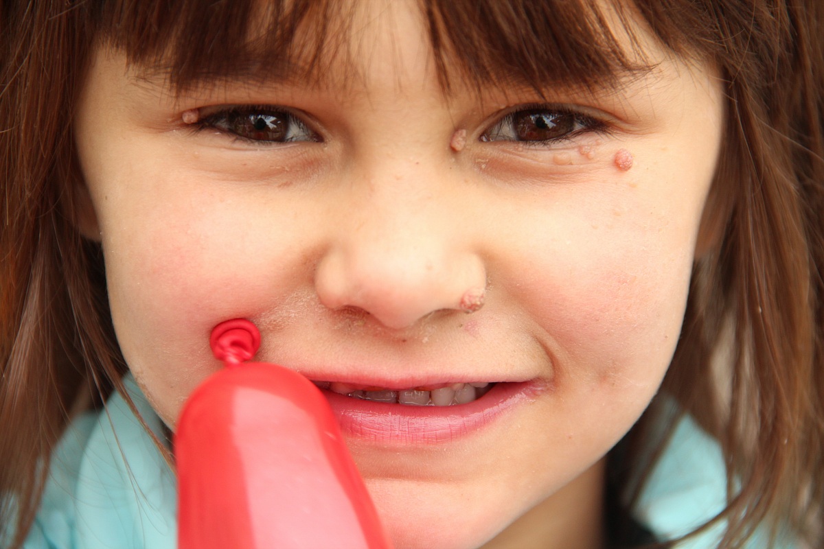 Bosnia and Herzegovina