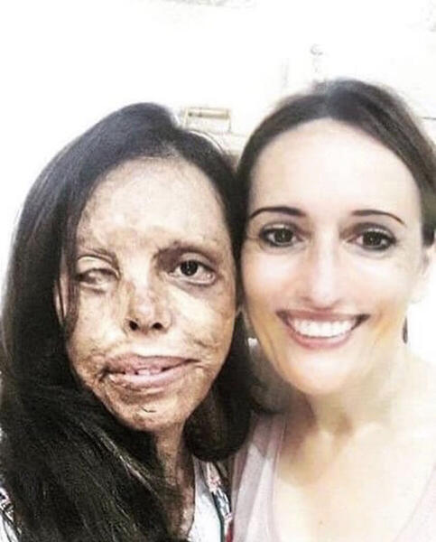 Foto