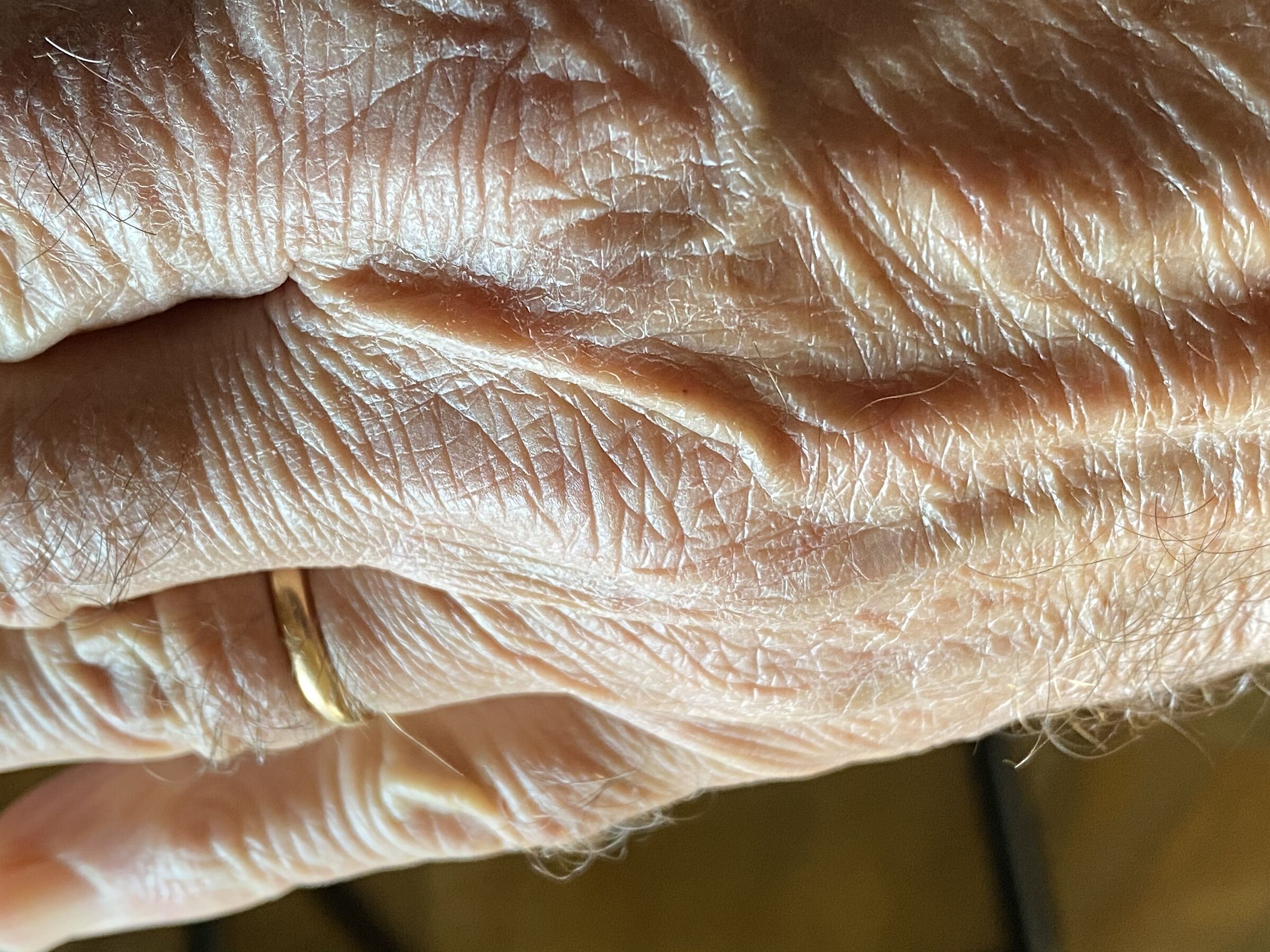 Hand