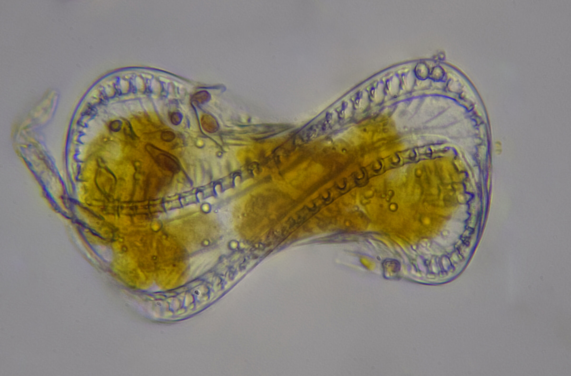 Diatom with micro diatoms inside