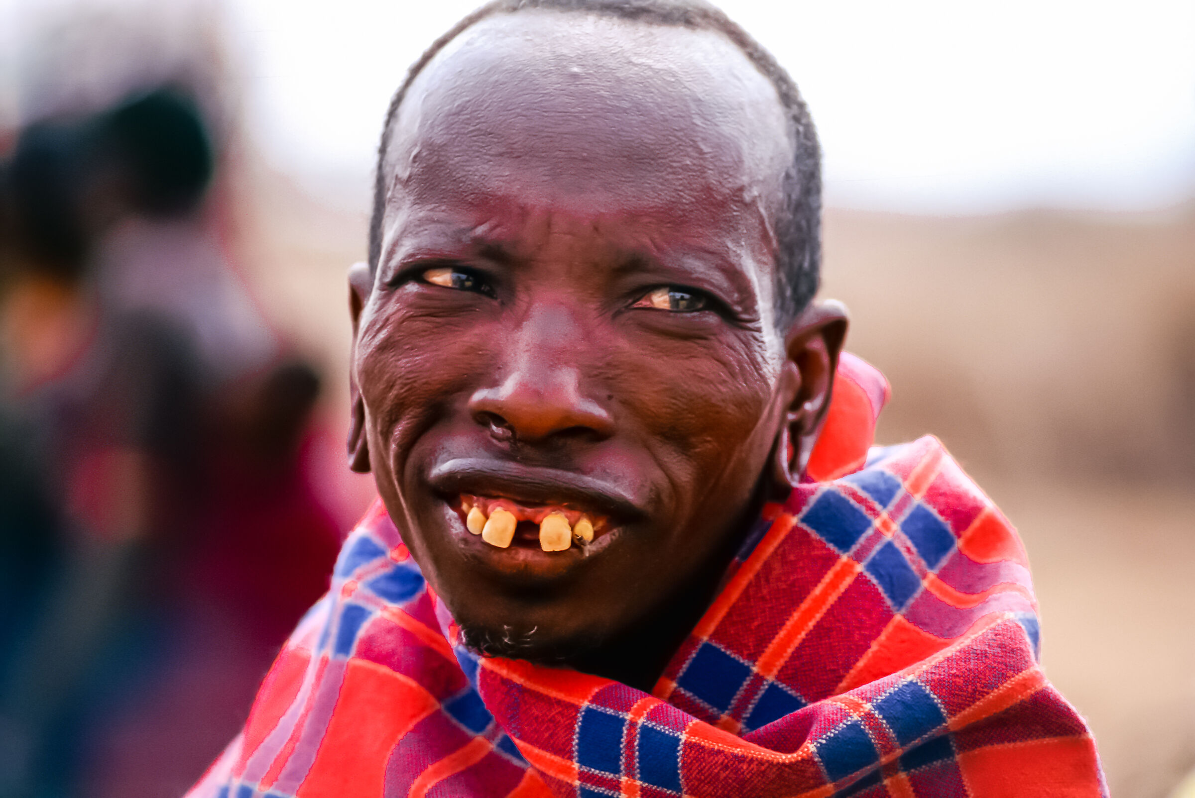 The dentone