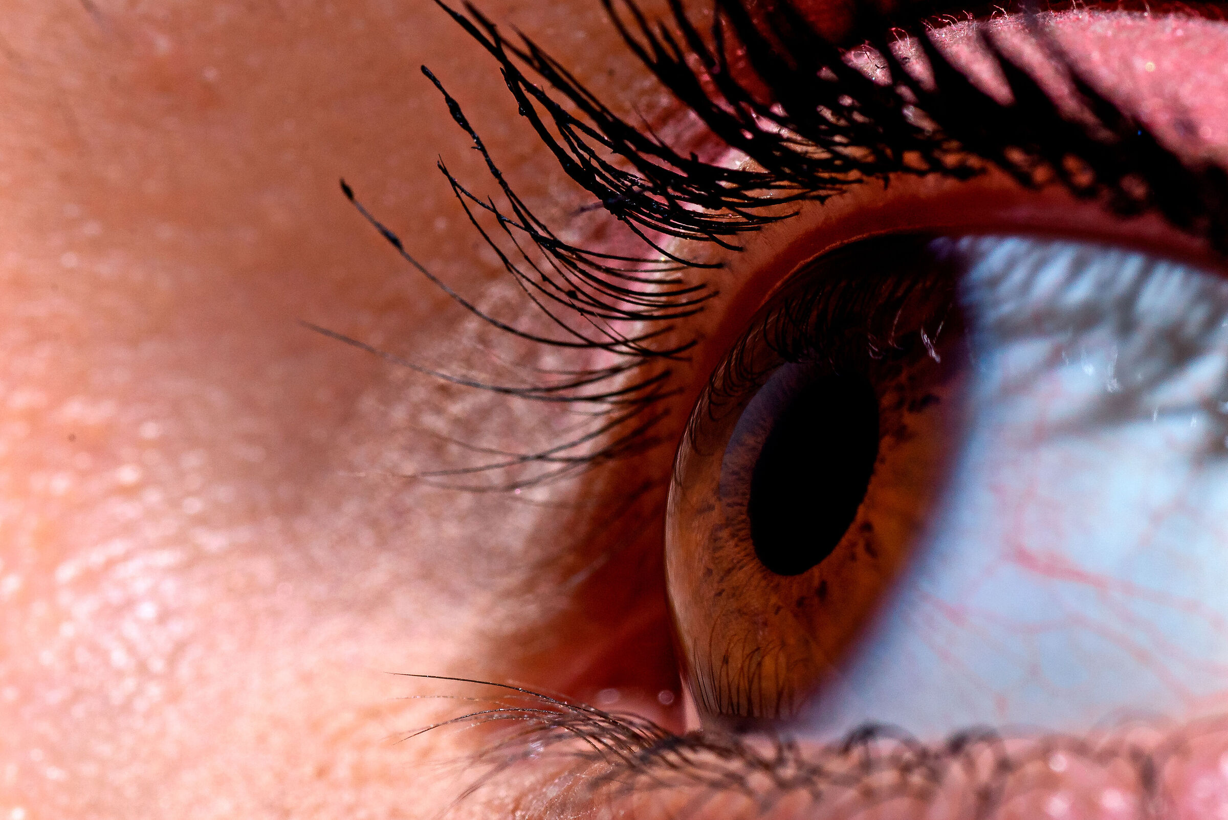 Eye