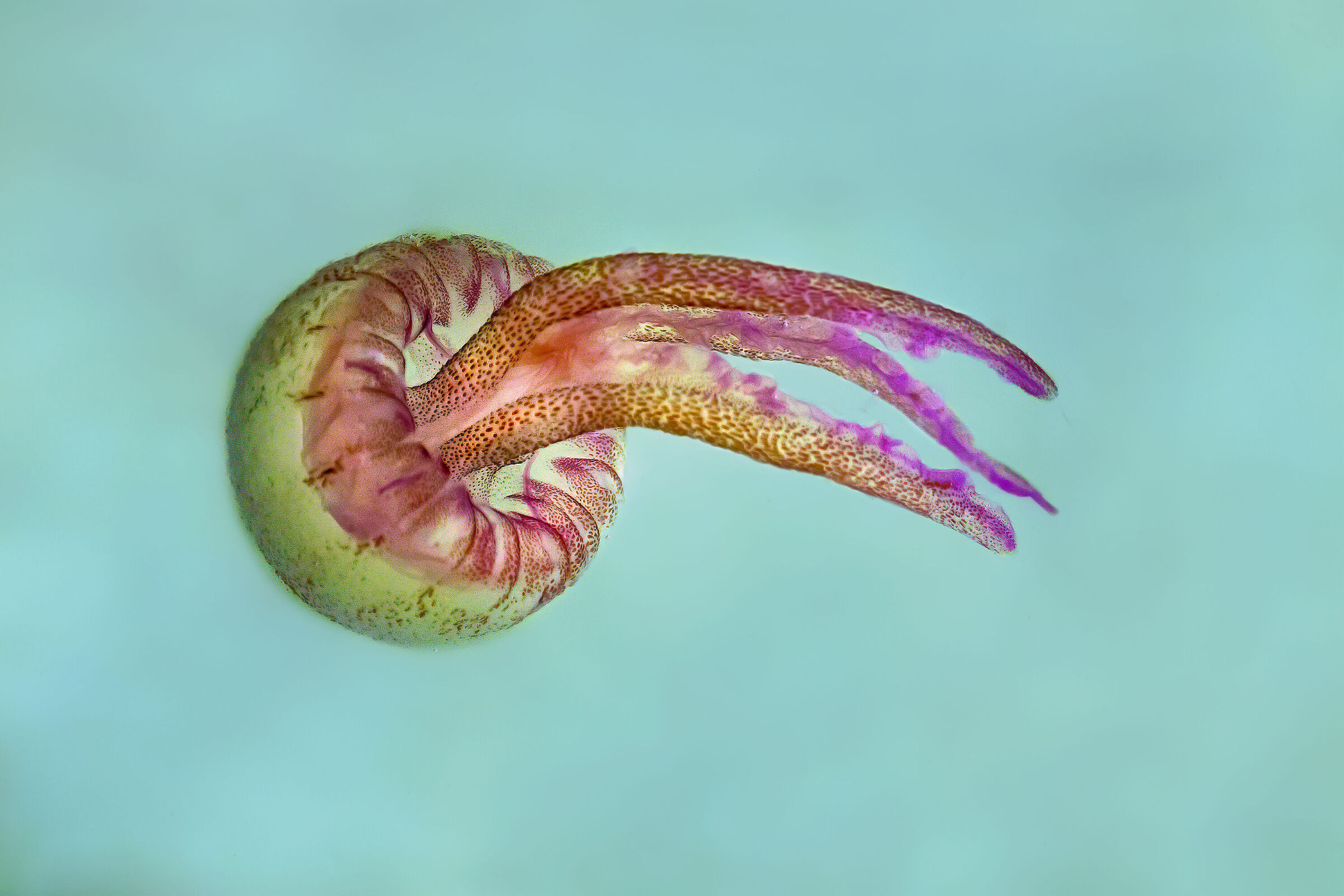 Pelagia noctiluca