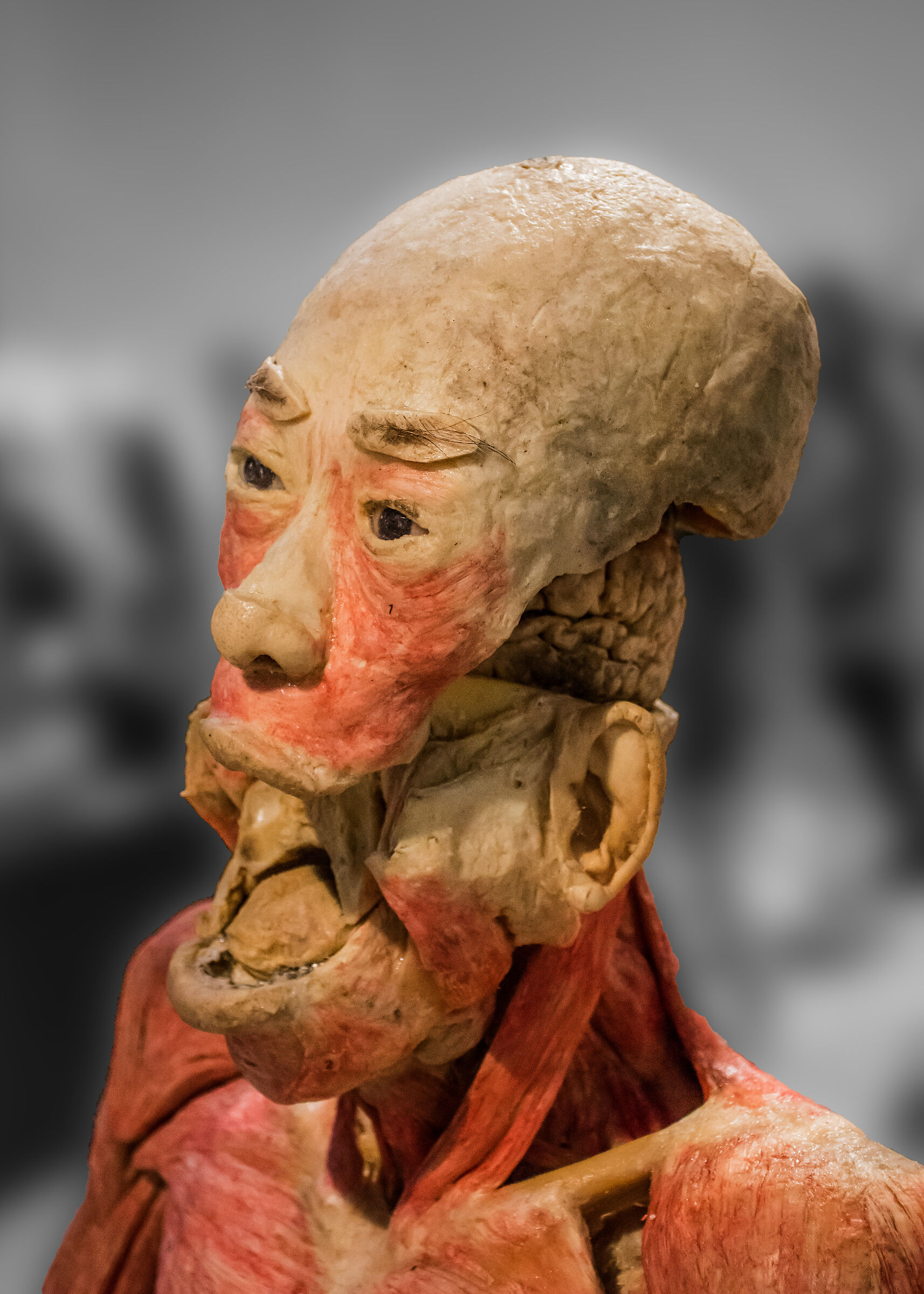 Plastination
