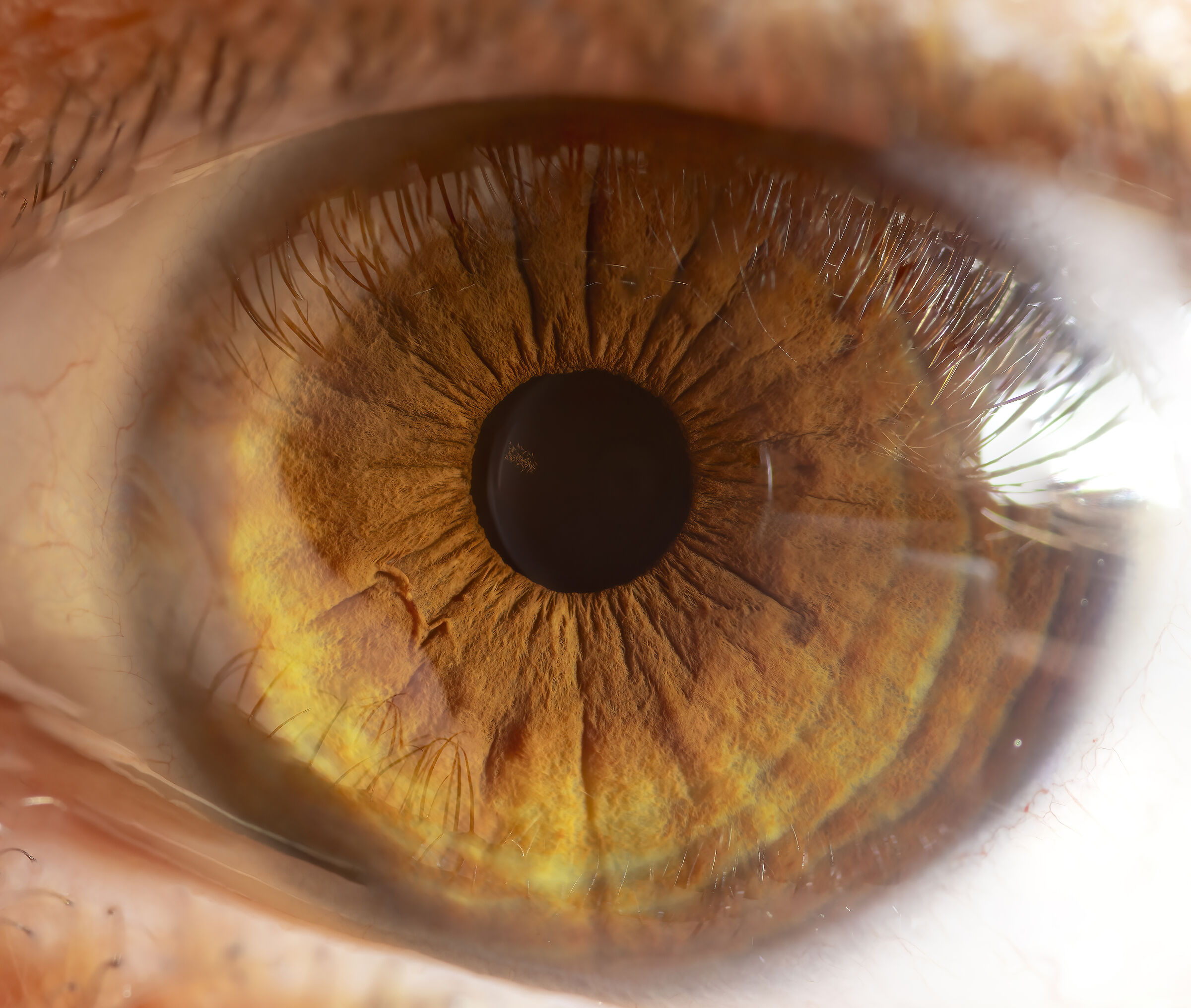 My eye
