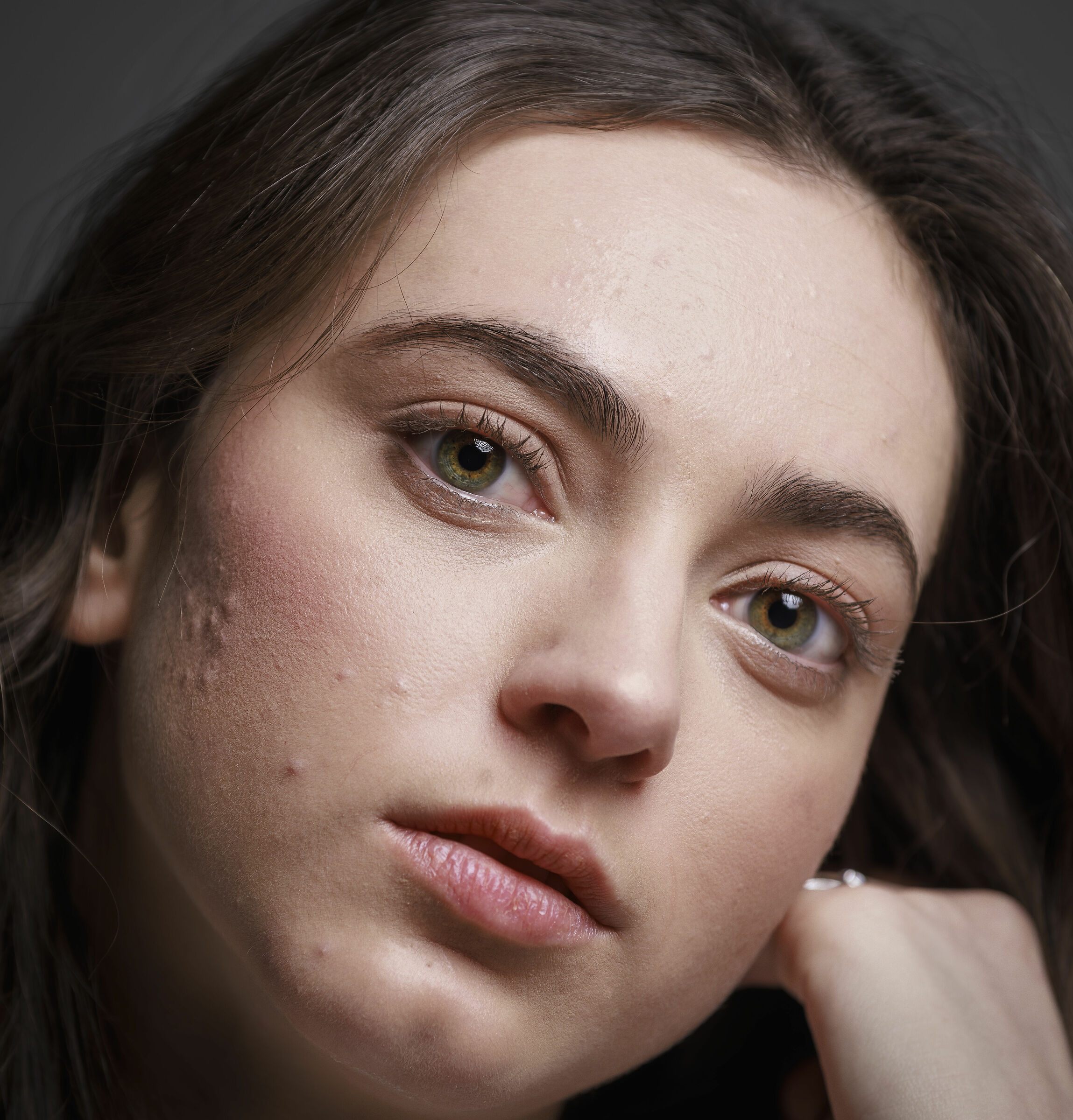 ELISA