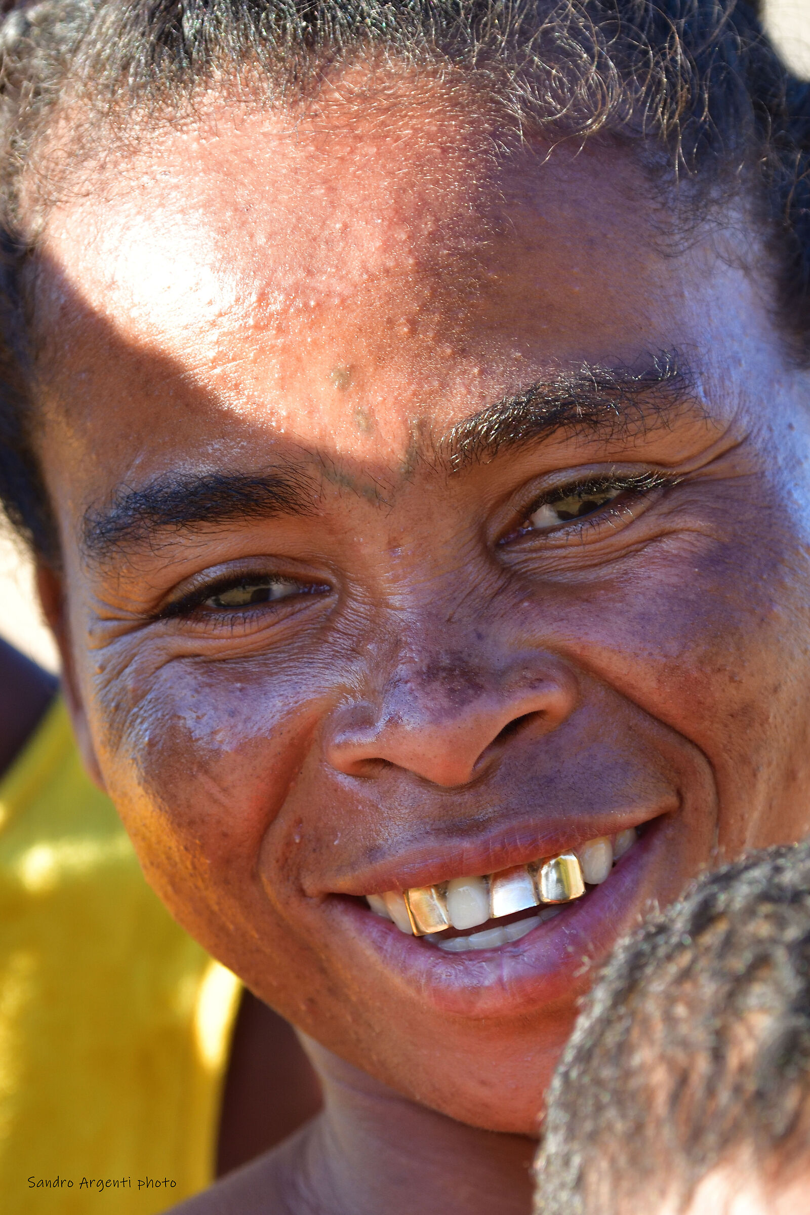 Sorriso di una donna Malgasci. Madagascar.