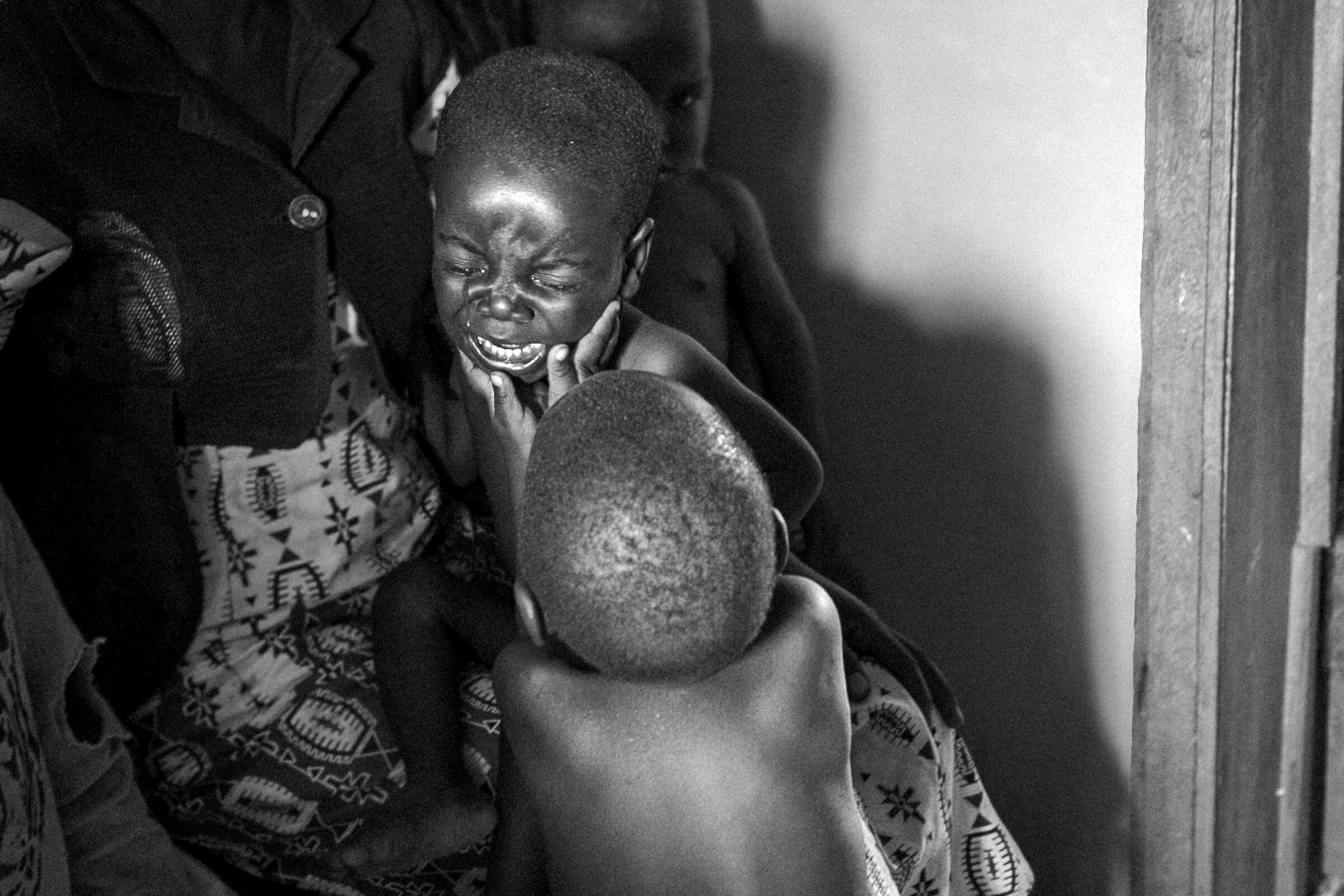 malnutrizione Repubblica Democratica del Congo