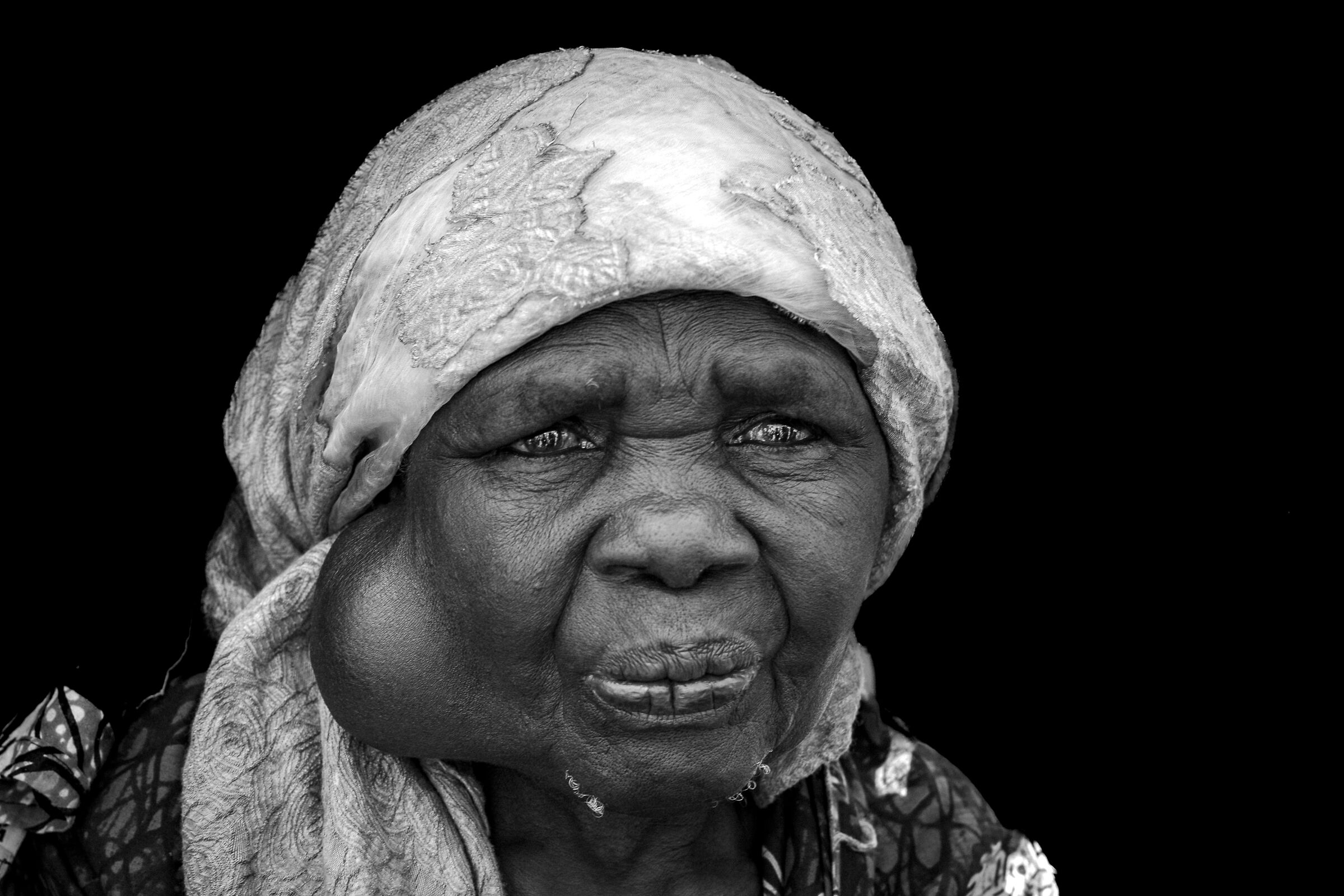 Refugee camps, Goma 2024 (DRC)