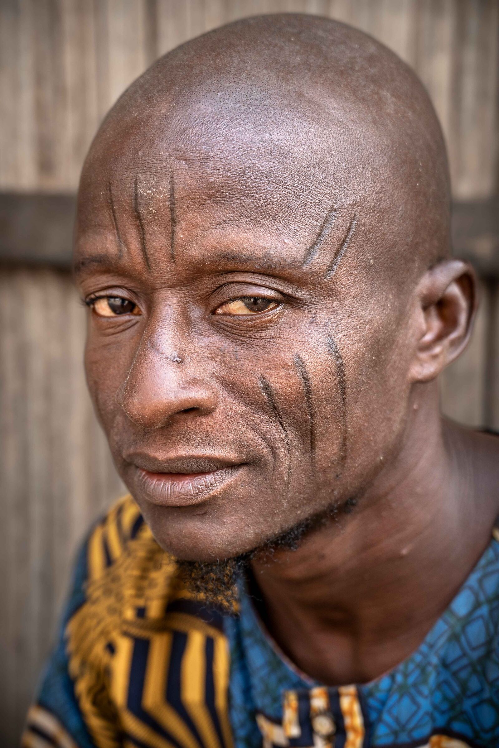 Holi Scarification