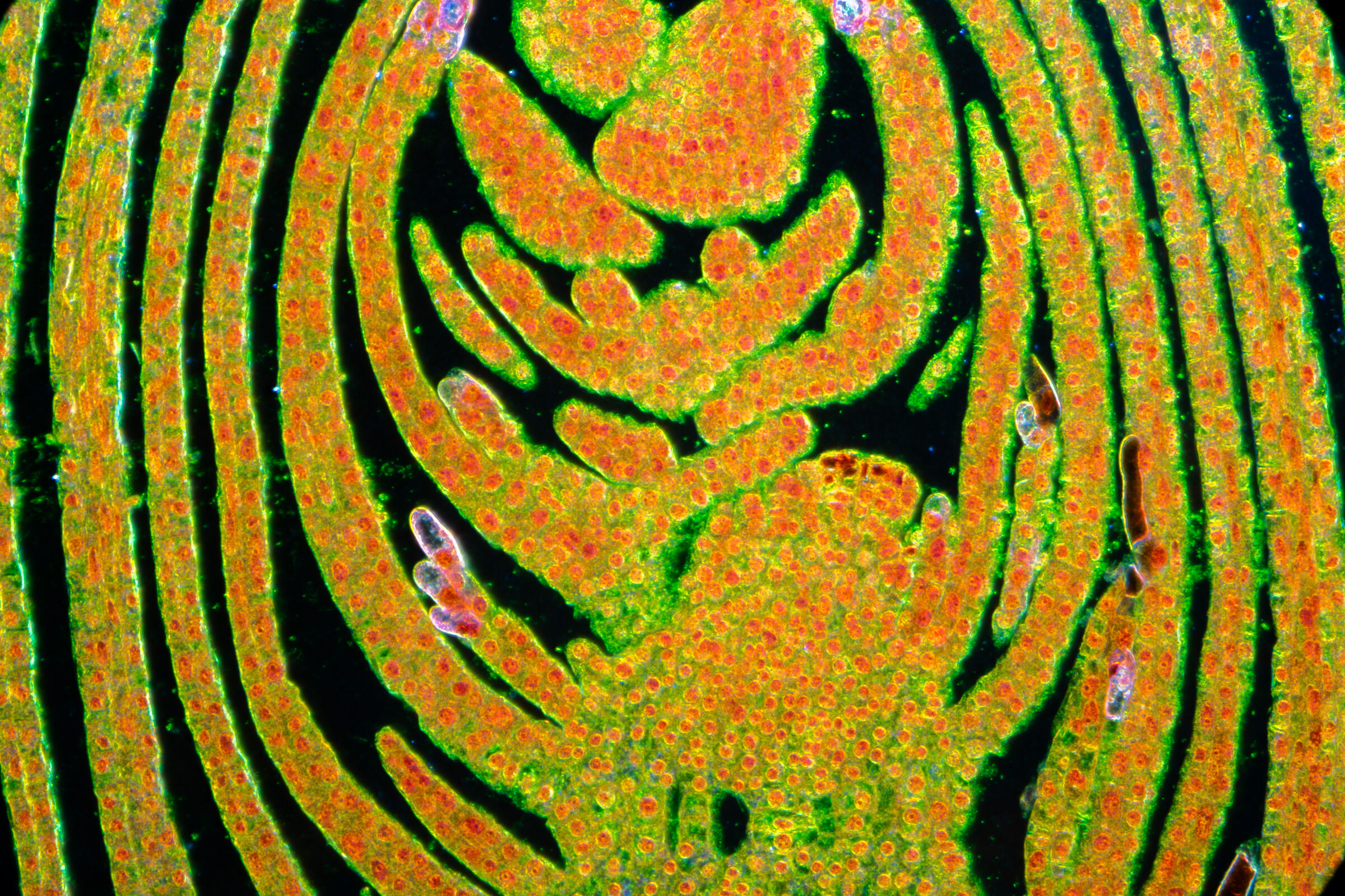 Dark field transillumination bud section