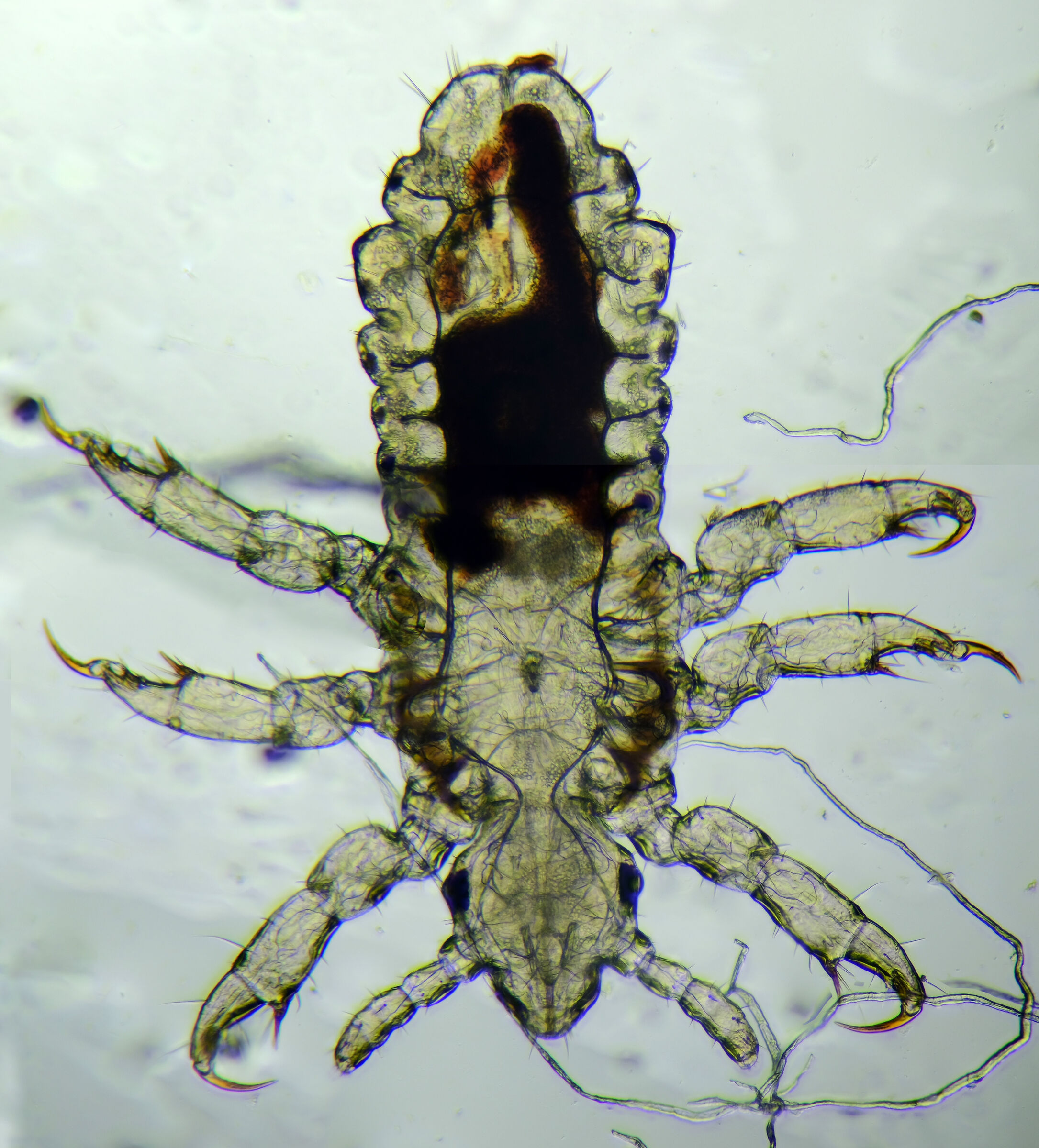 Human Head Louse Nymph