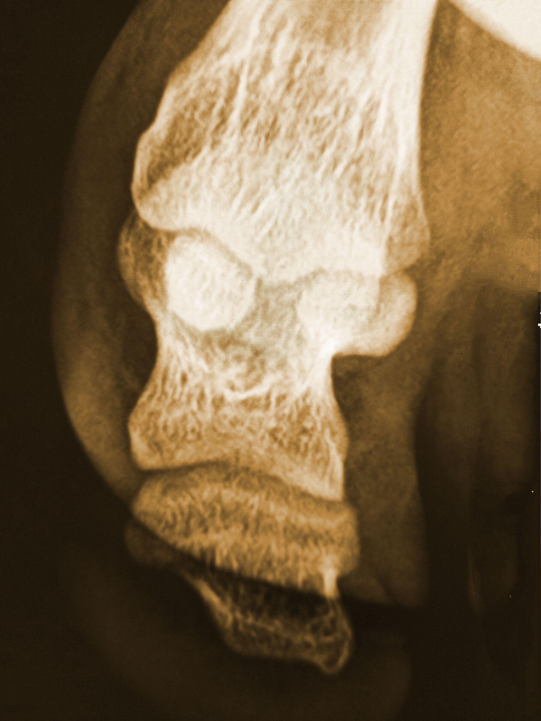 Dolore Articolare Diaboliko